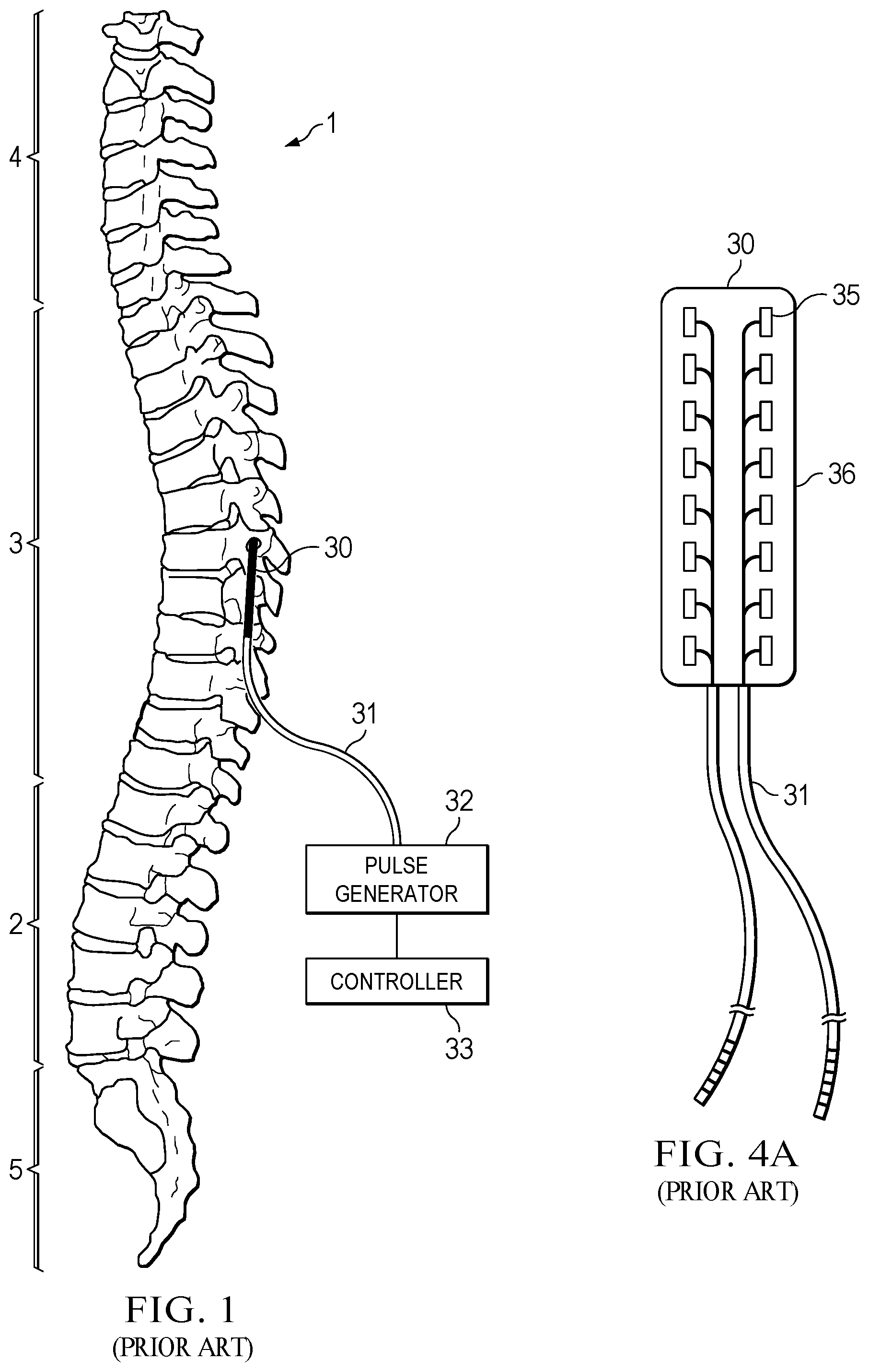 Patent US12090322 — Randomized intermittent stimulation paradigm and method of use — Figure 1