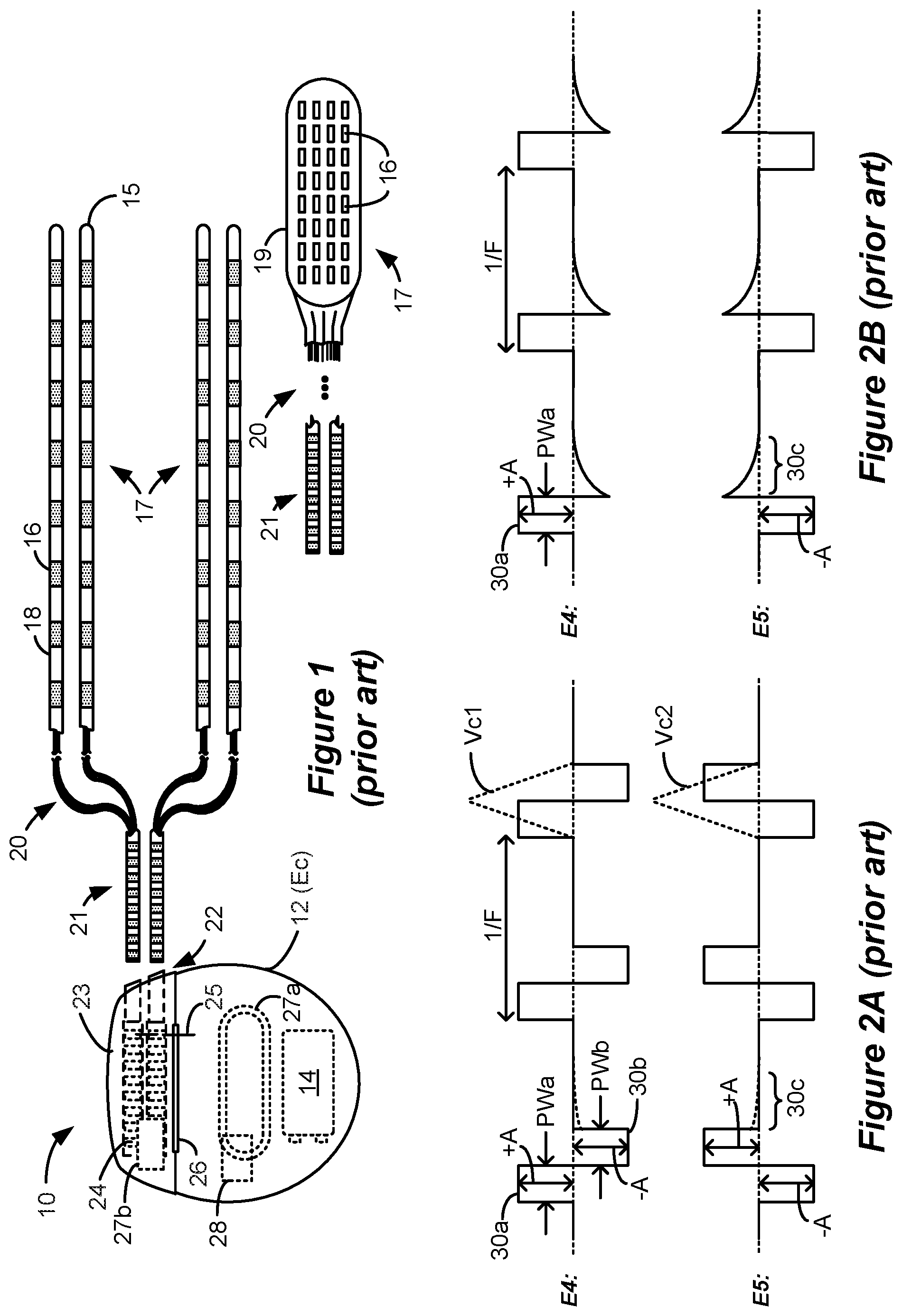 Patent US12090324 — Spinal cord stimulation for dorsal column recruitment or suppression using anodic and cathodic pulses — Figure 1