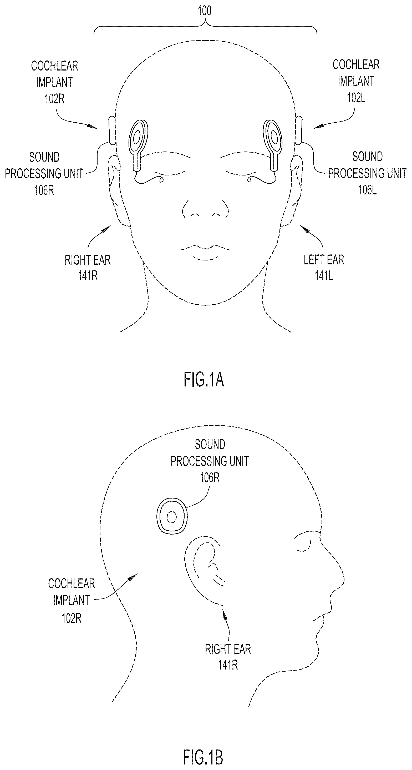 Patent US12090327 — Synchronized pitch and timing cues in a hearing prosthesis system — Figure 1