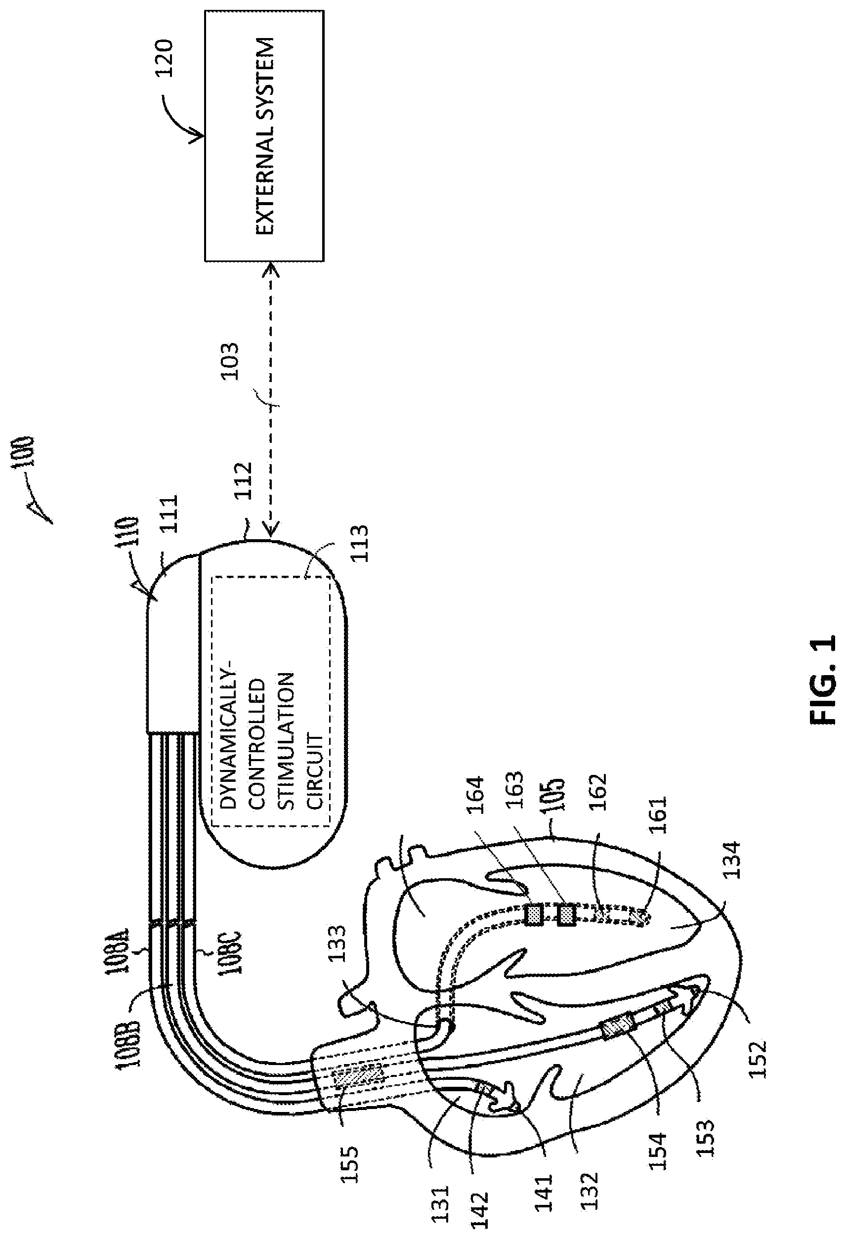 Patent US12090328 — Dynamic atrioventricular delay optimization — Figure 1