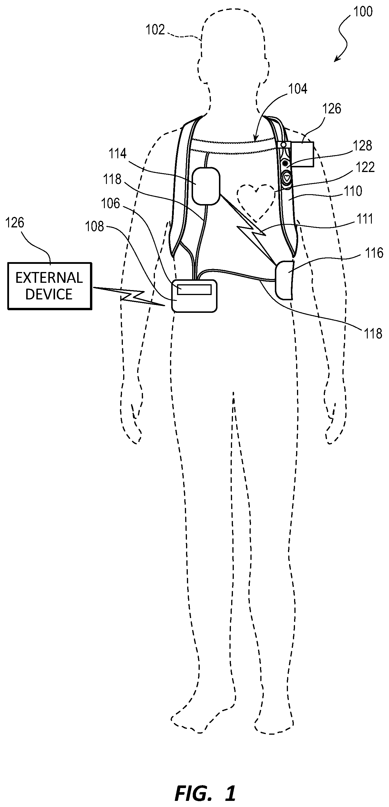 Patent US12090333 Figure 1 – Managing alerts in a WCD system