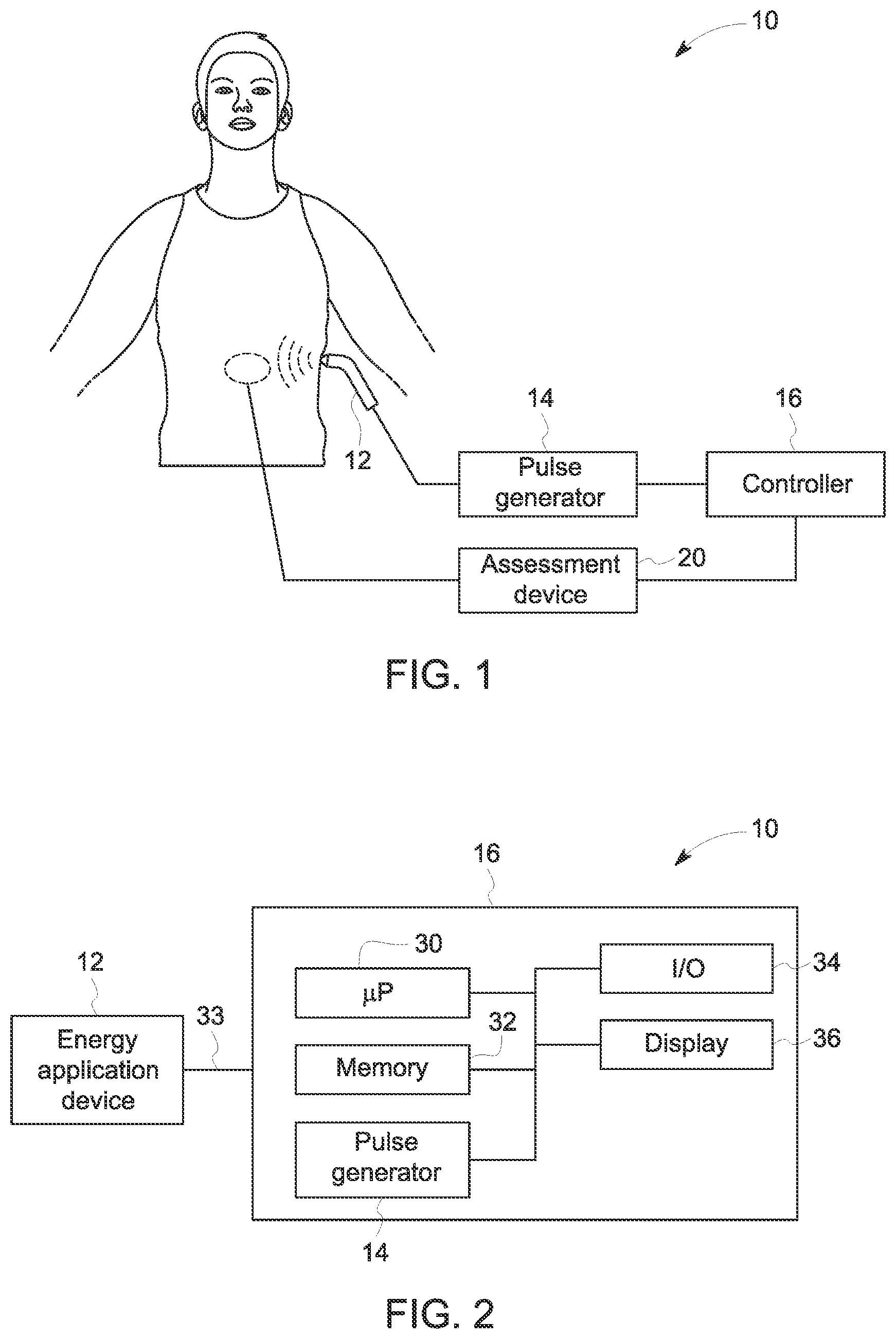 Patent US12090346 Figure 1 – Neuromodulation techniques