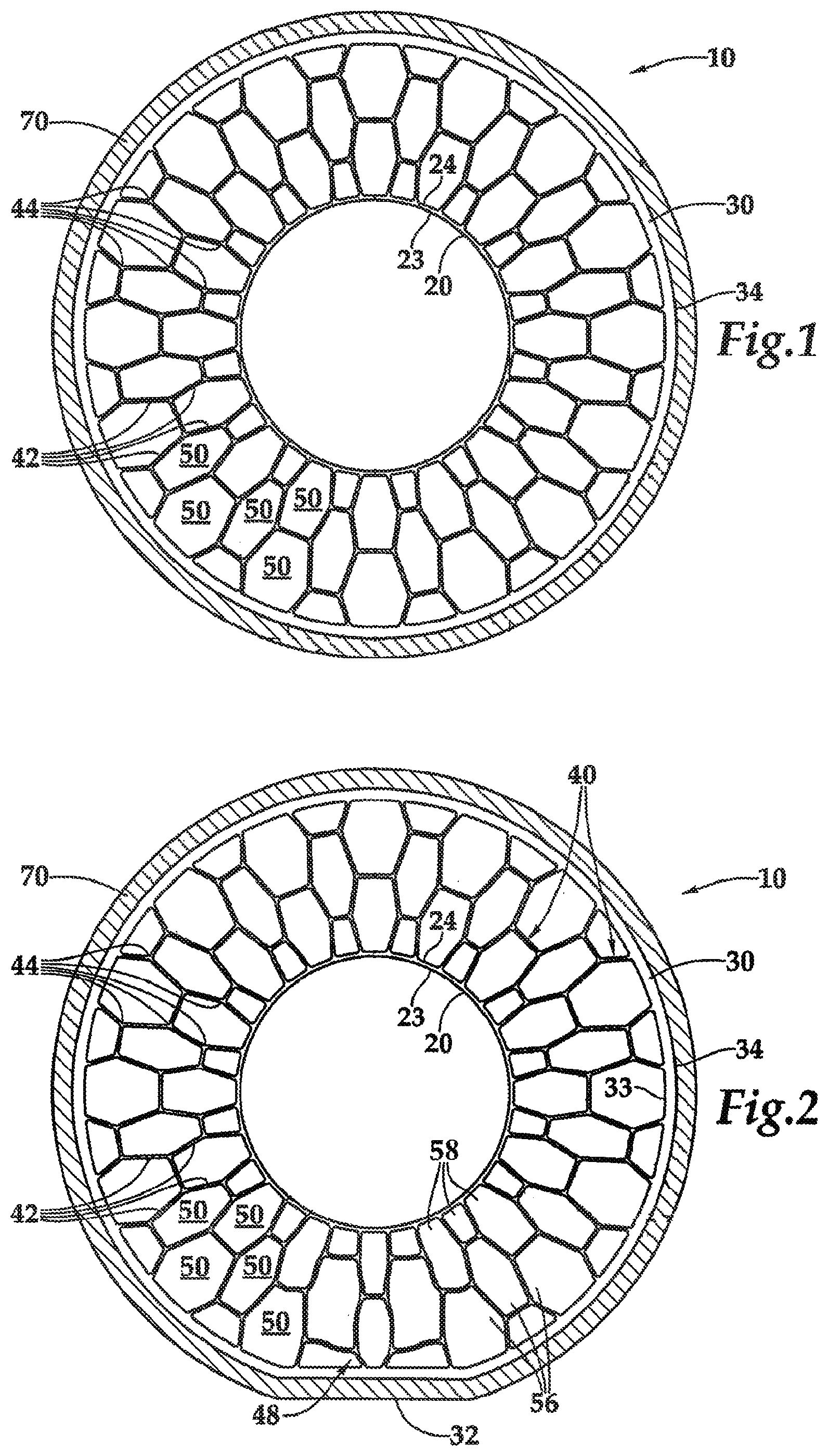 Patent US12090801 — Non-pneumatic tire having reinforced outer ring — Figure 1