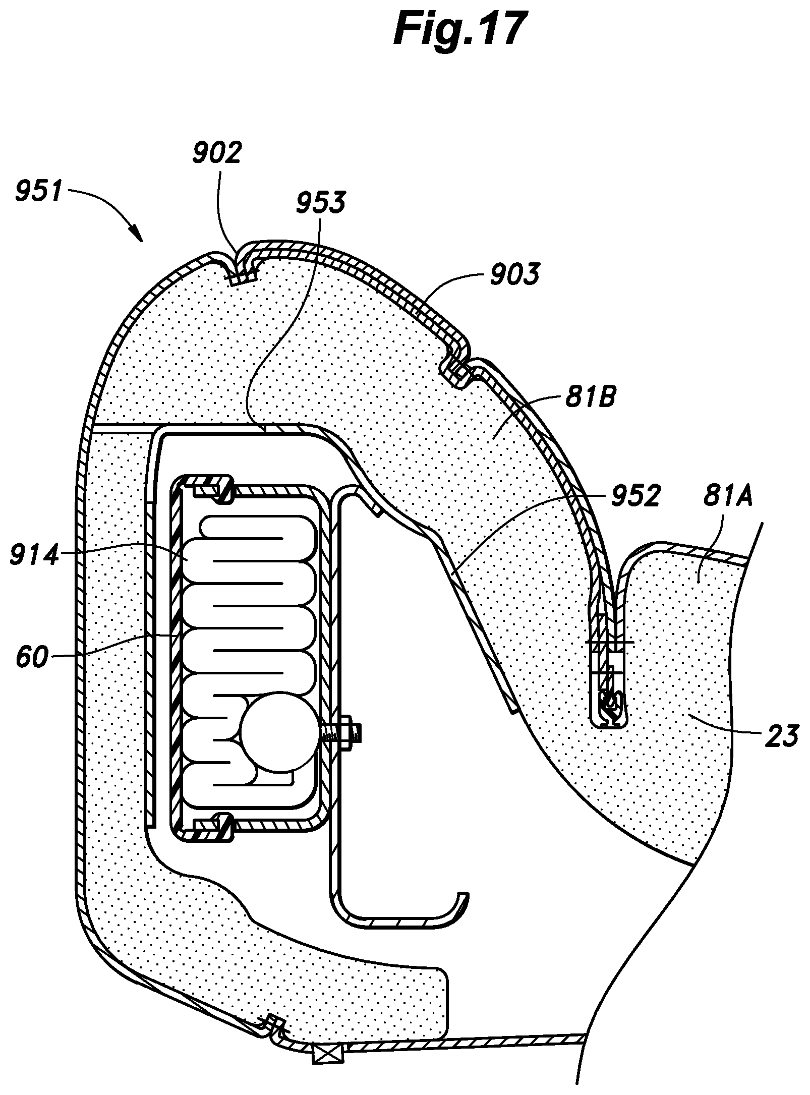 Patent US12090945 Figure 17 – Vehicle seat