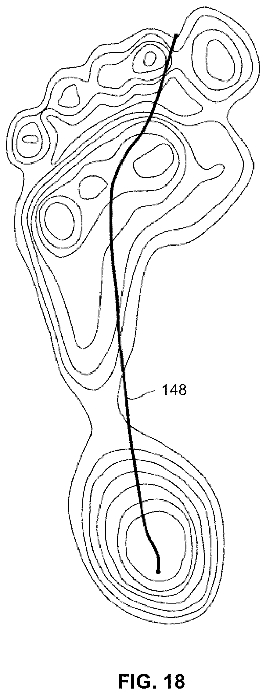 Patent US12096825 Figure 15 – Outsole pattern for an article of footwear