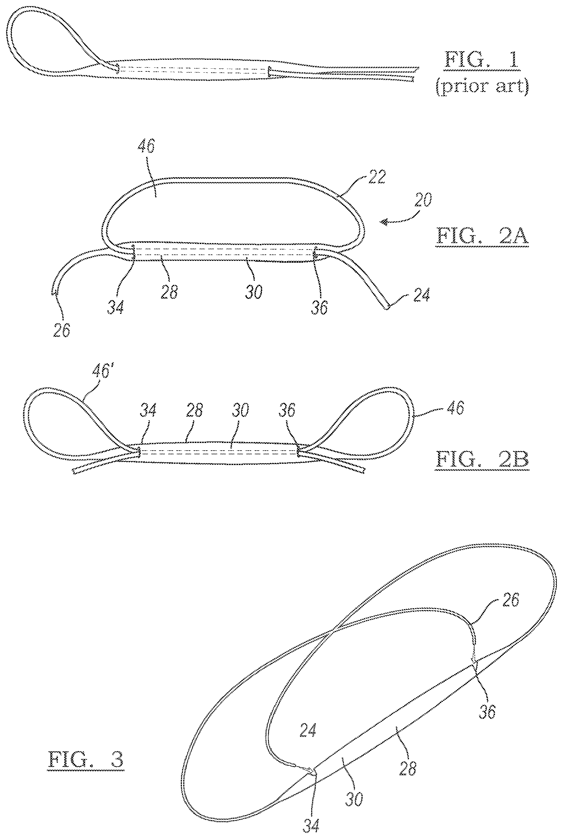 Patent US12096928 — Method and apparatus for coupling soft tissue to a bone — Figure 1