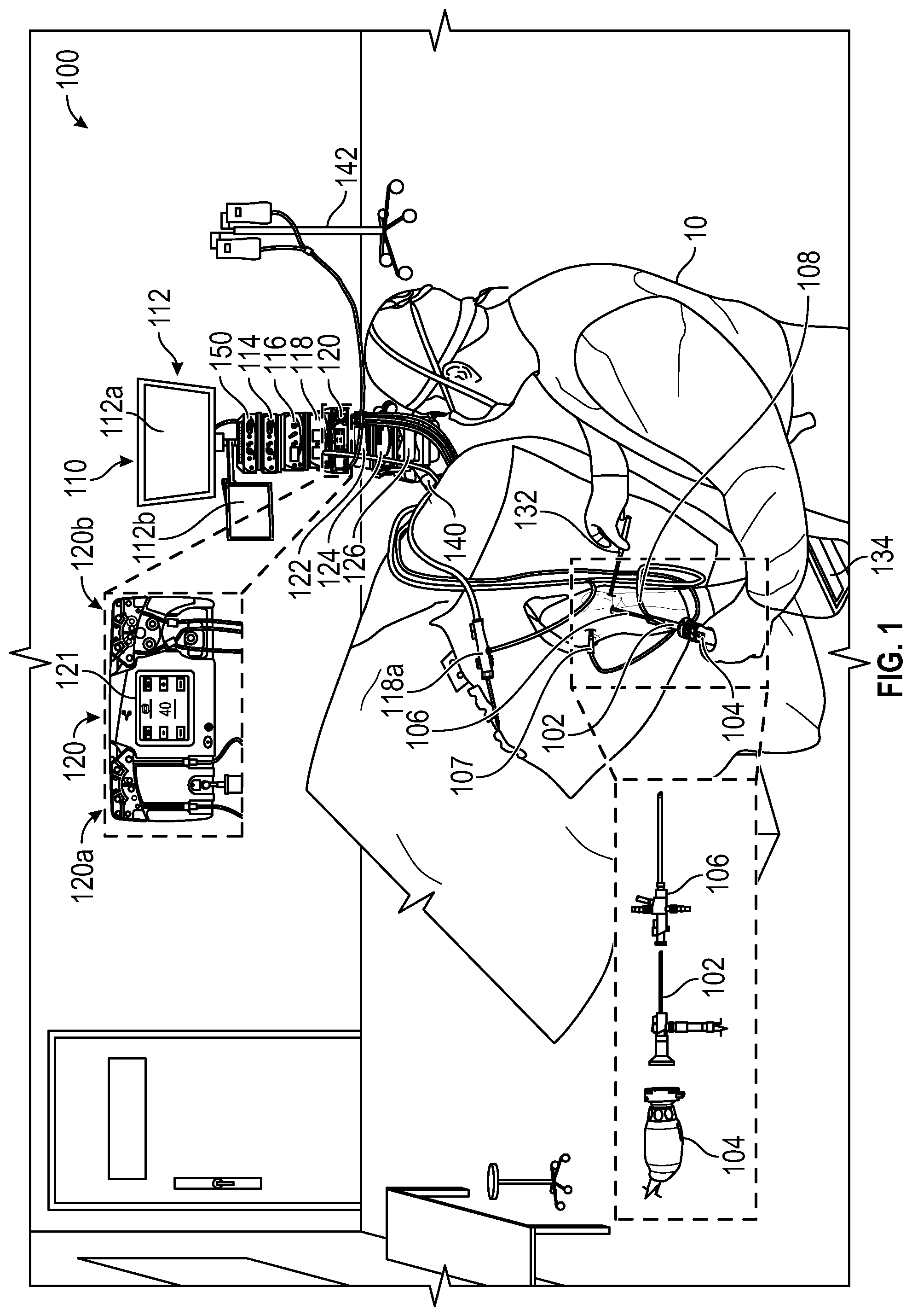 Patent US12096945 — Systems and devices for endoscopic procedure analysis based on state data — Figure 1