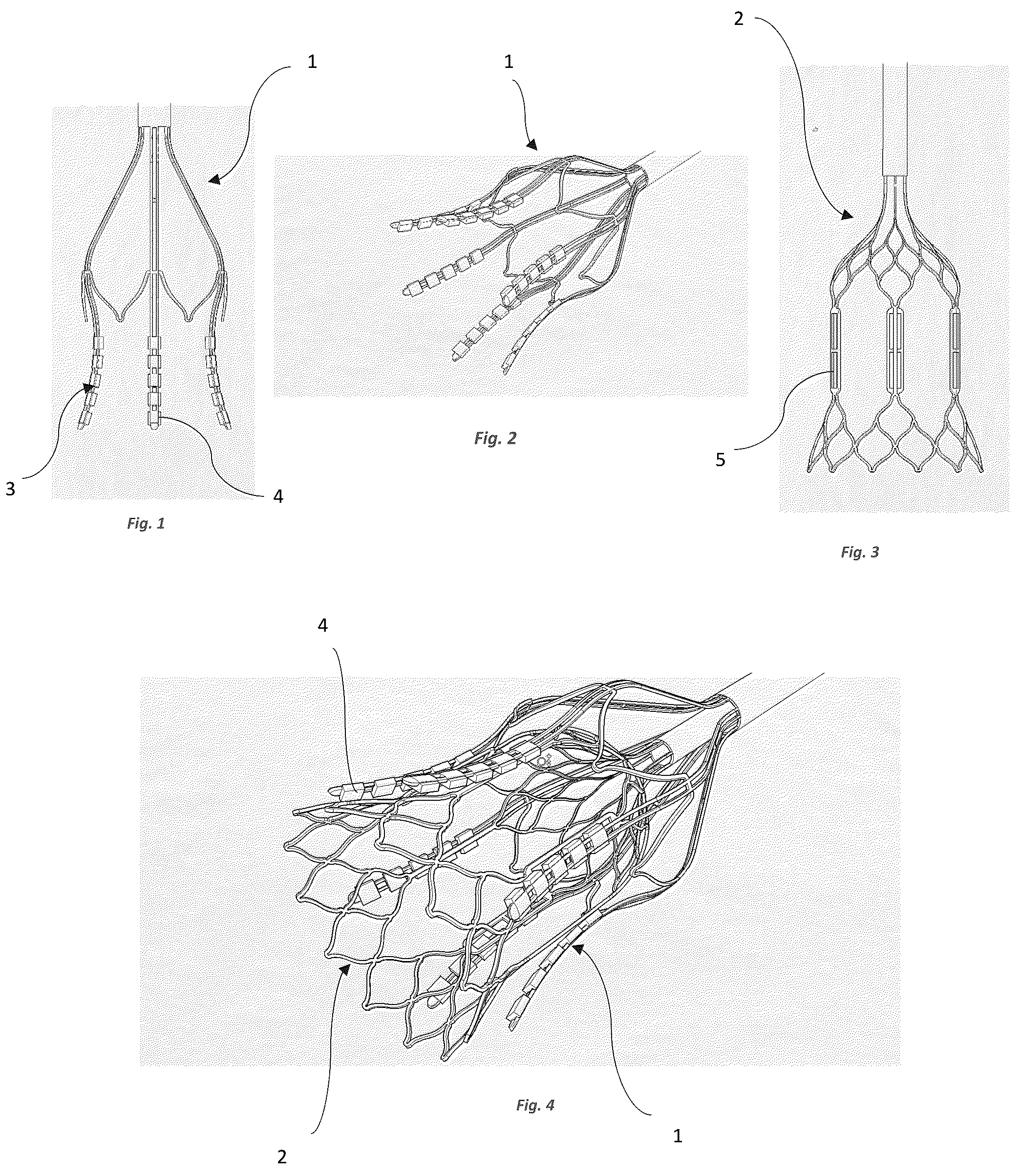 Patent US12096949 Figure 1 – Device for the treatment of tissue calcification