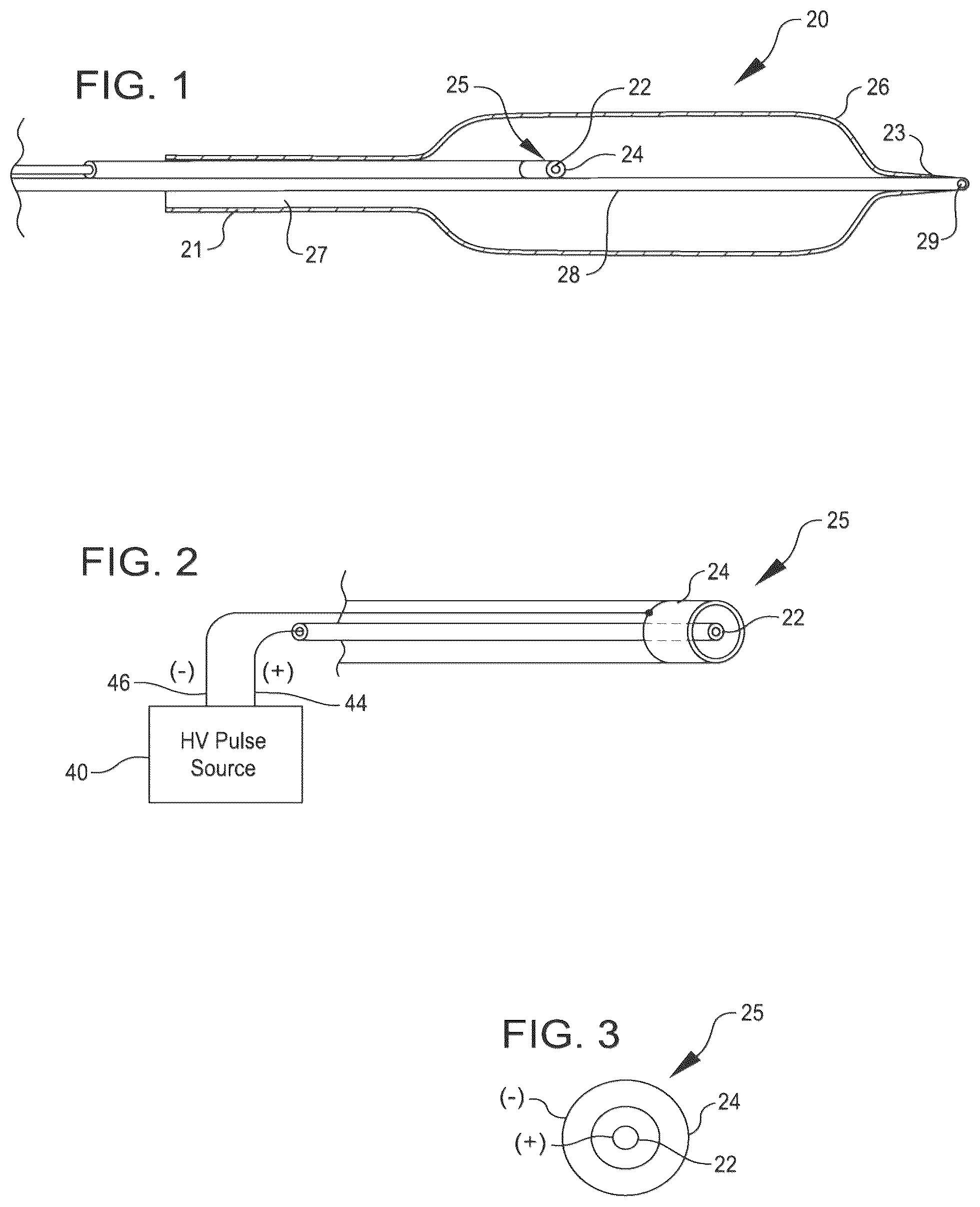 Patent US12096950 — Shockwave catheter system with energy control — Figure 1