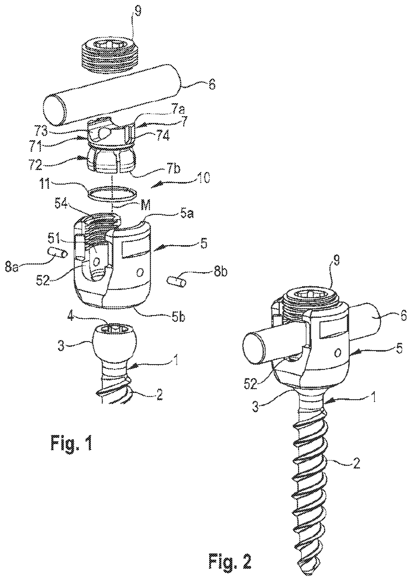 Patent US12096963 — Coupling assembly for coupling a rod to a bone anchoring element and bone anchoring device with such a coupling assembly — Figure 1