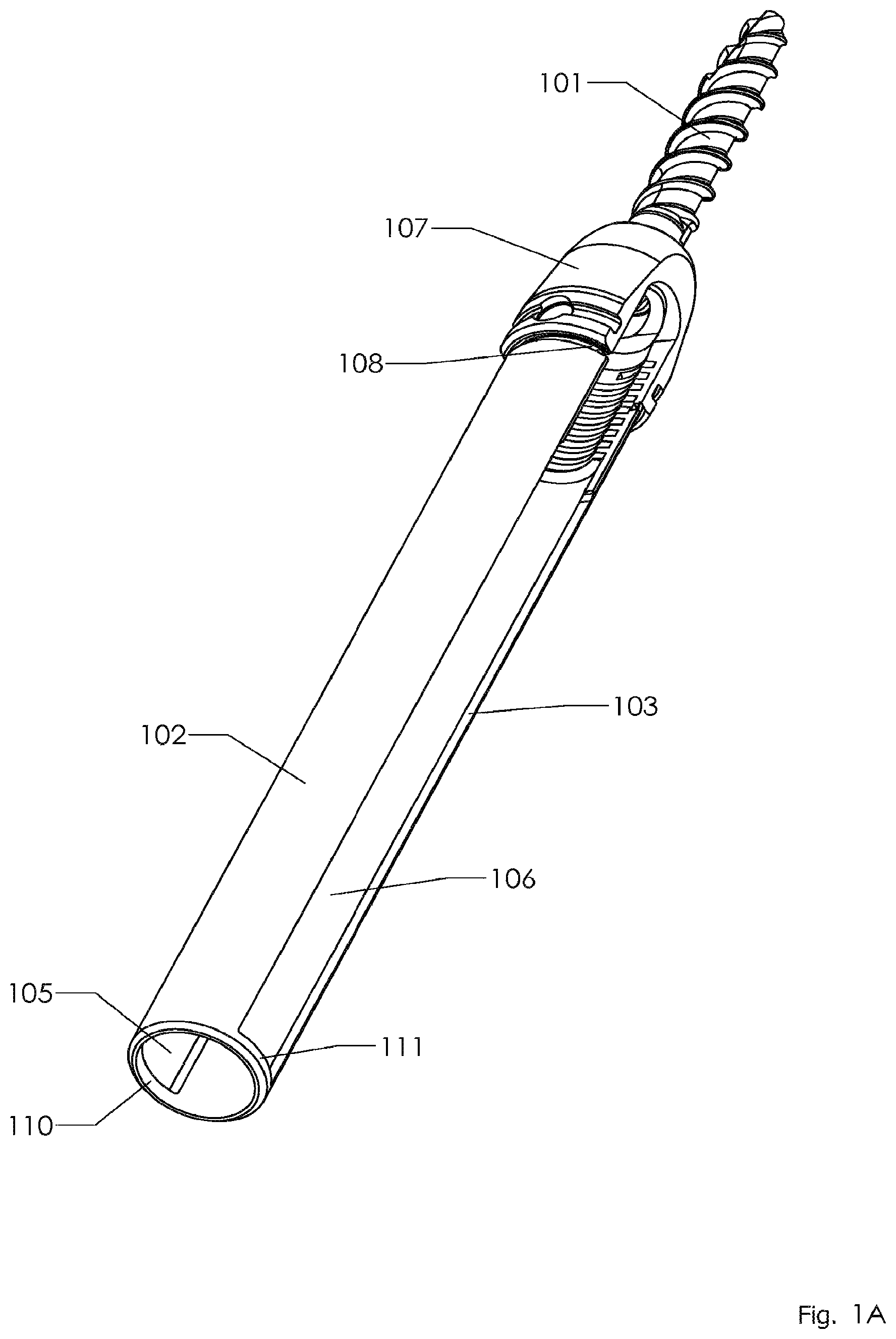 Patent US12096965 — Minimally invasive pedicle screw extension sleeve system — Figure 1