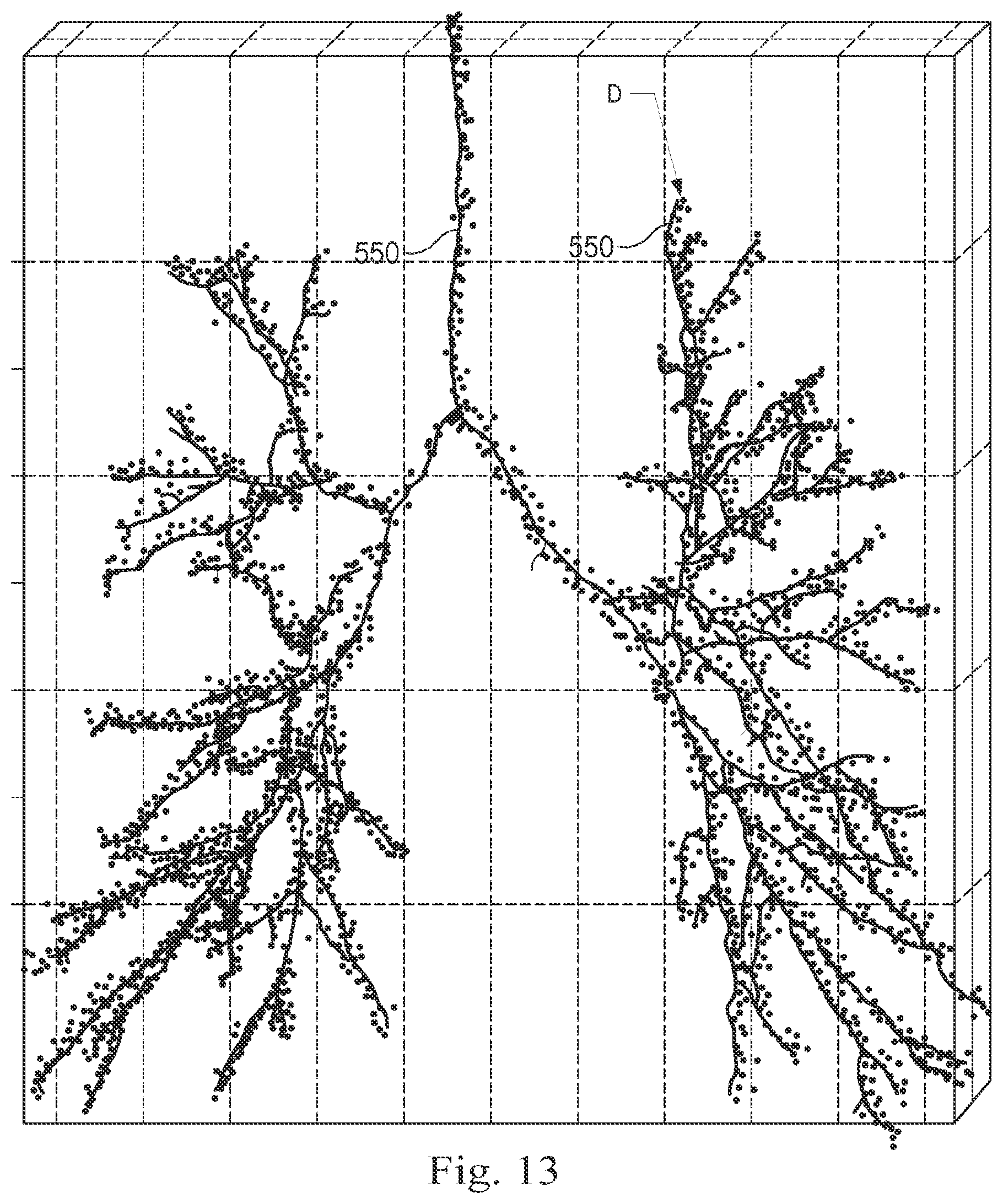 Patent US12096996 Figure 12 – Systems and methods of registration for image-guided procedures