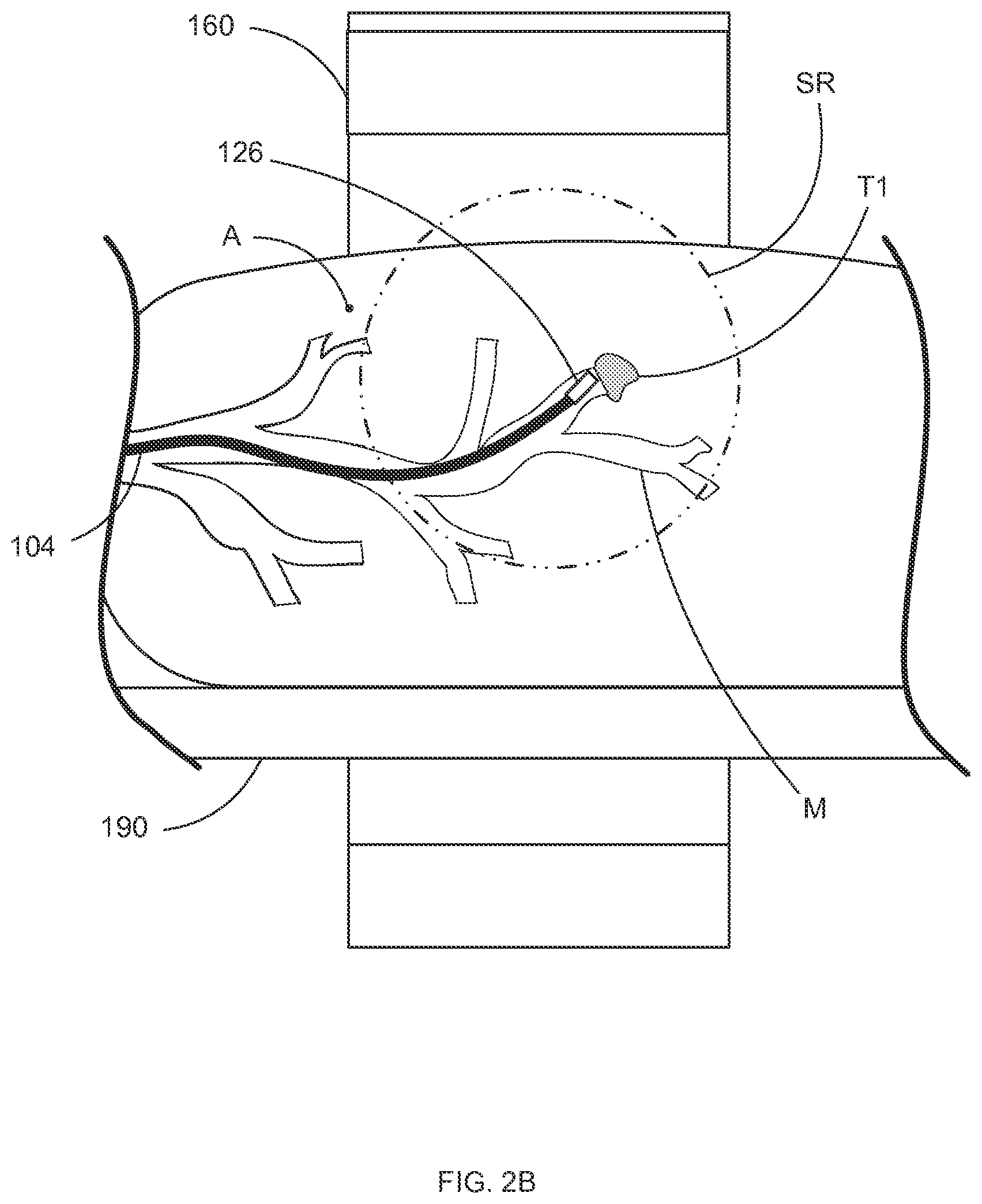 Patent US12097000 Figure 4 – Systems and methods for robotic medical system integration with external imaging