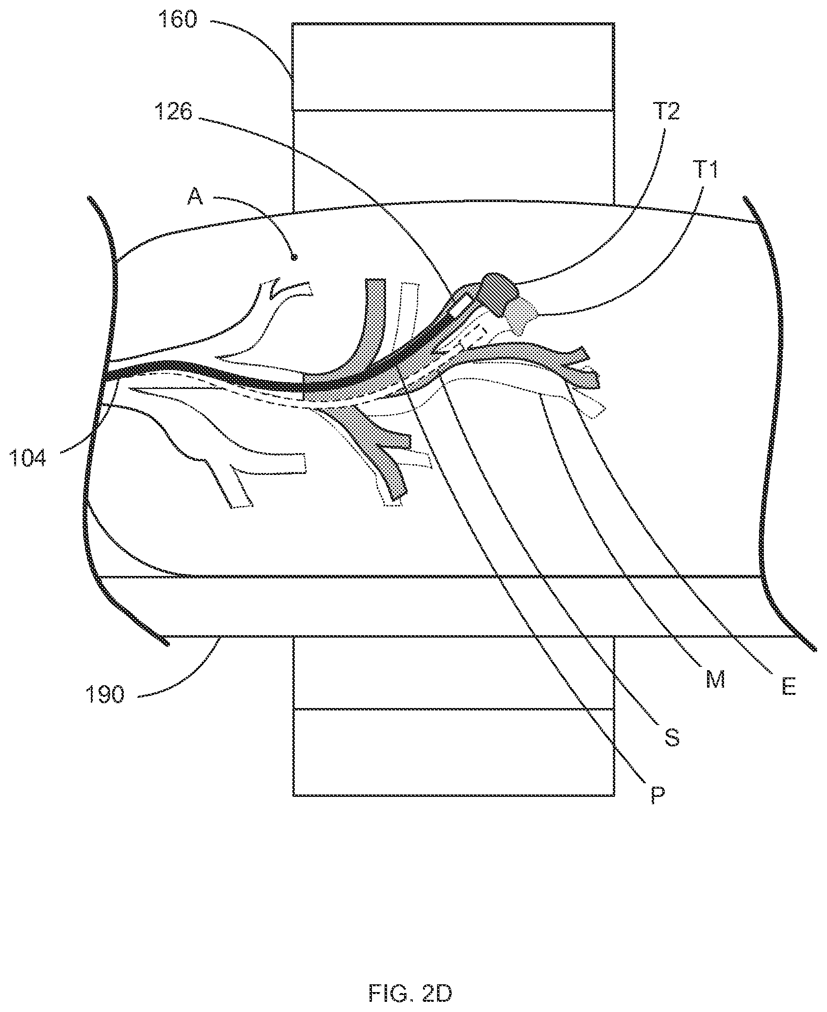 Patent US12097000 Figure 6 – Systems and methods for robotic medical system integration with external imaging