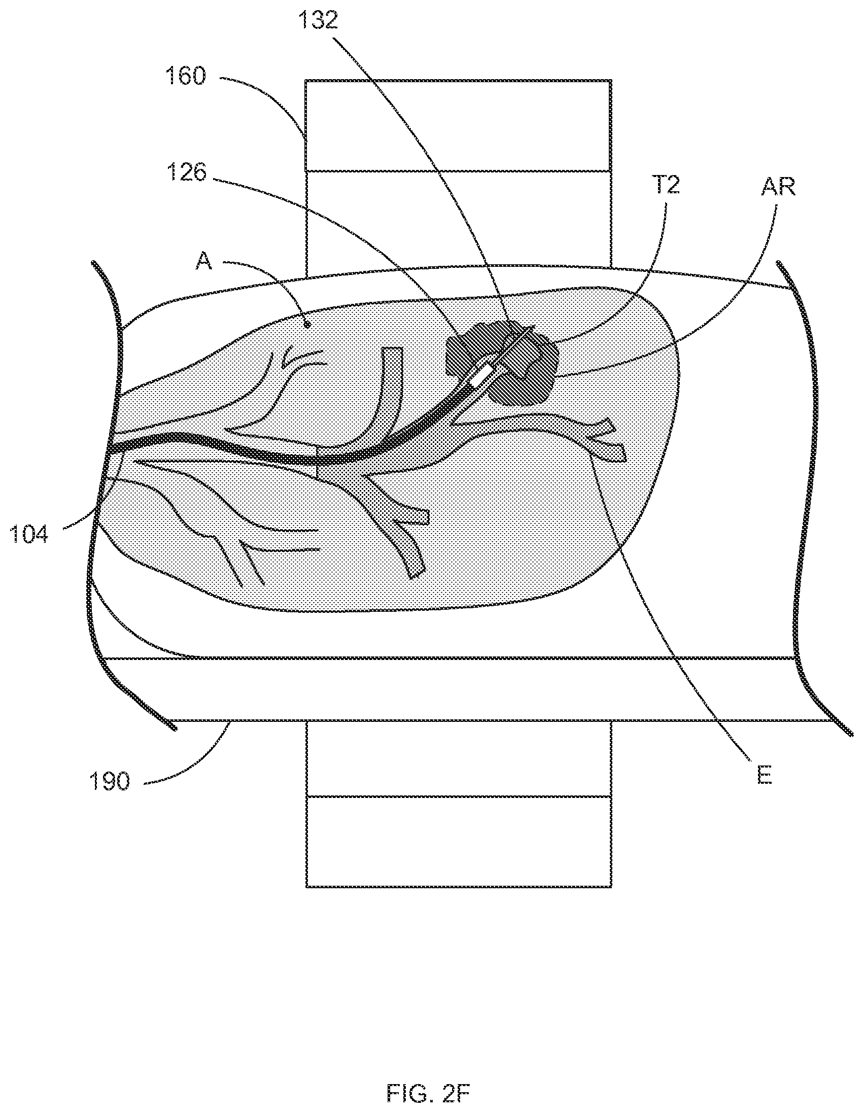 Patent US12097000 Figure 8 – Systems and methods for robotic medical system integration with external imaging