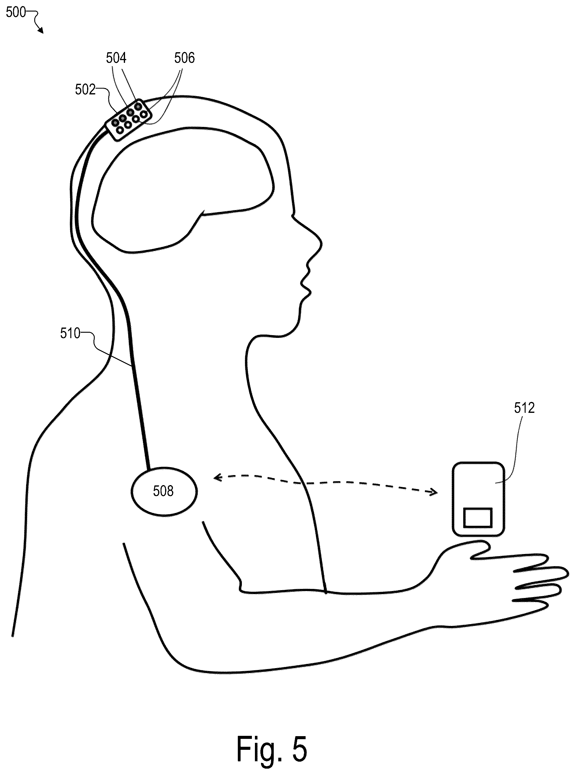 Patent US12097010 Figure 5 – Maintaining consistent photodetector sensitivity in an optical measurement system