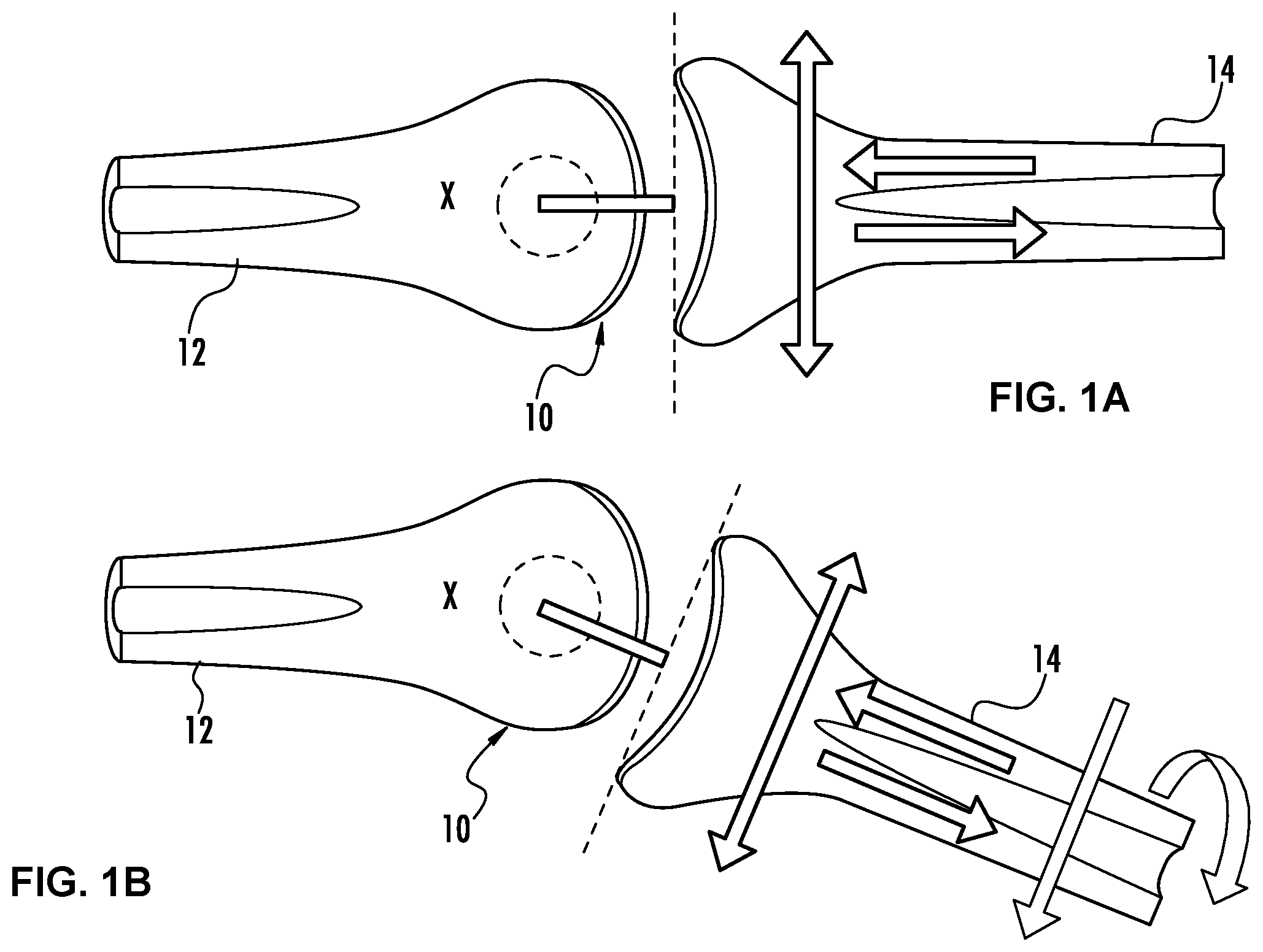 Patent US12097023 Figure 1 – Device for sensing displacement during a joint mobilization procedure and method for using such a device to quantify joint mobilization and detect joint laxity