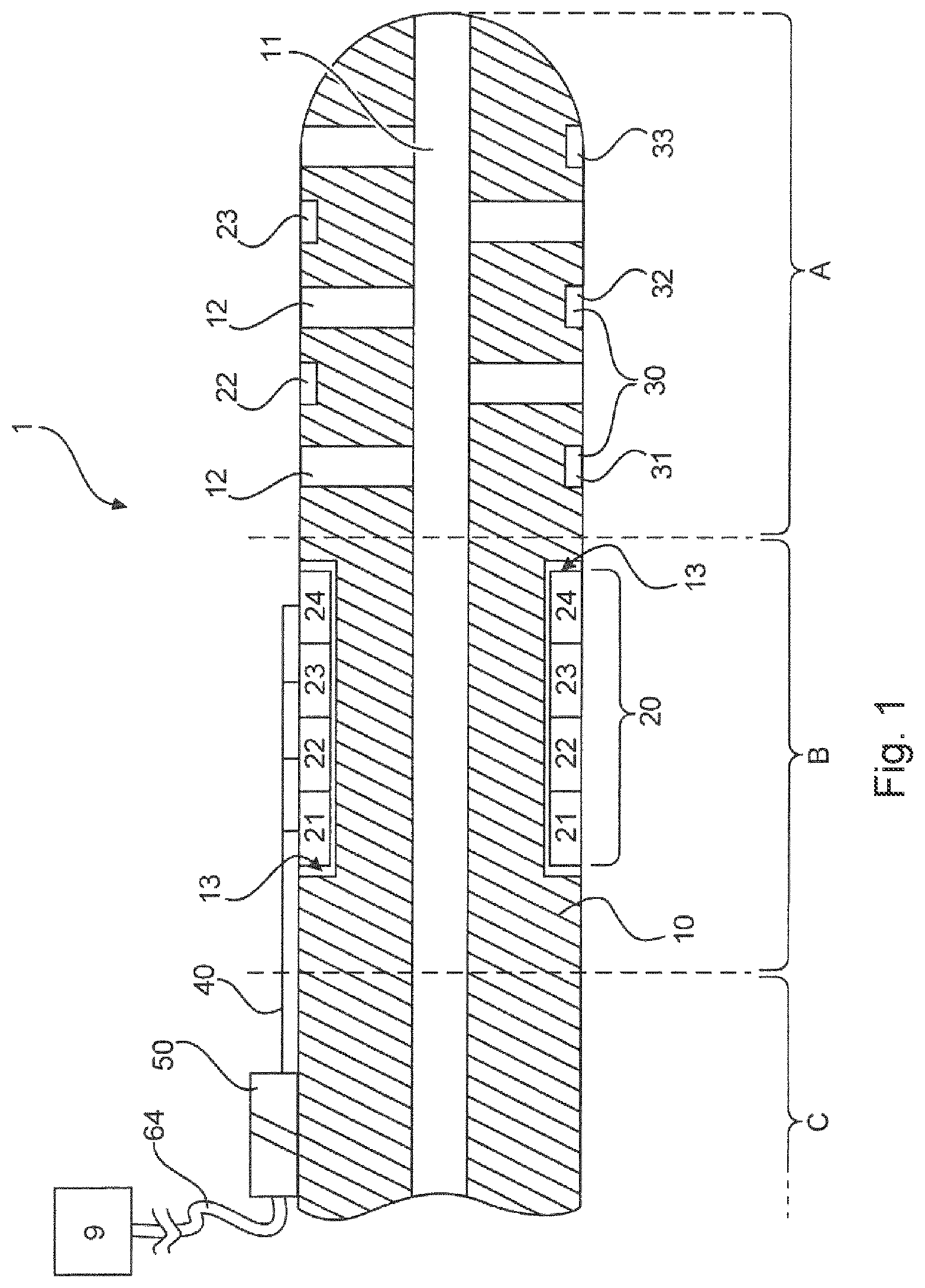 Patent US12097047 — Device for drainage of the brain — Figure 1