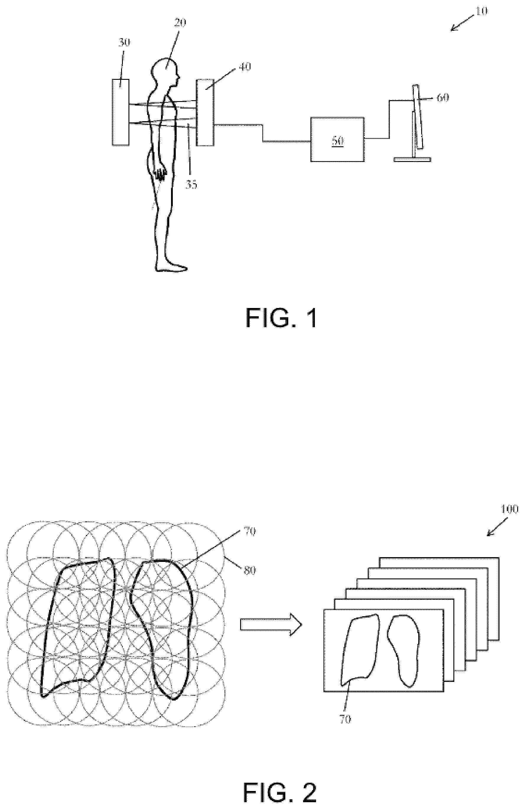 Patent US12097053 — Method of obtaining x-ray images — Figure 1