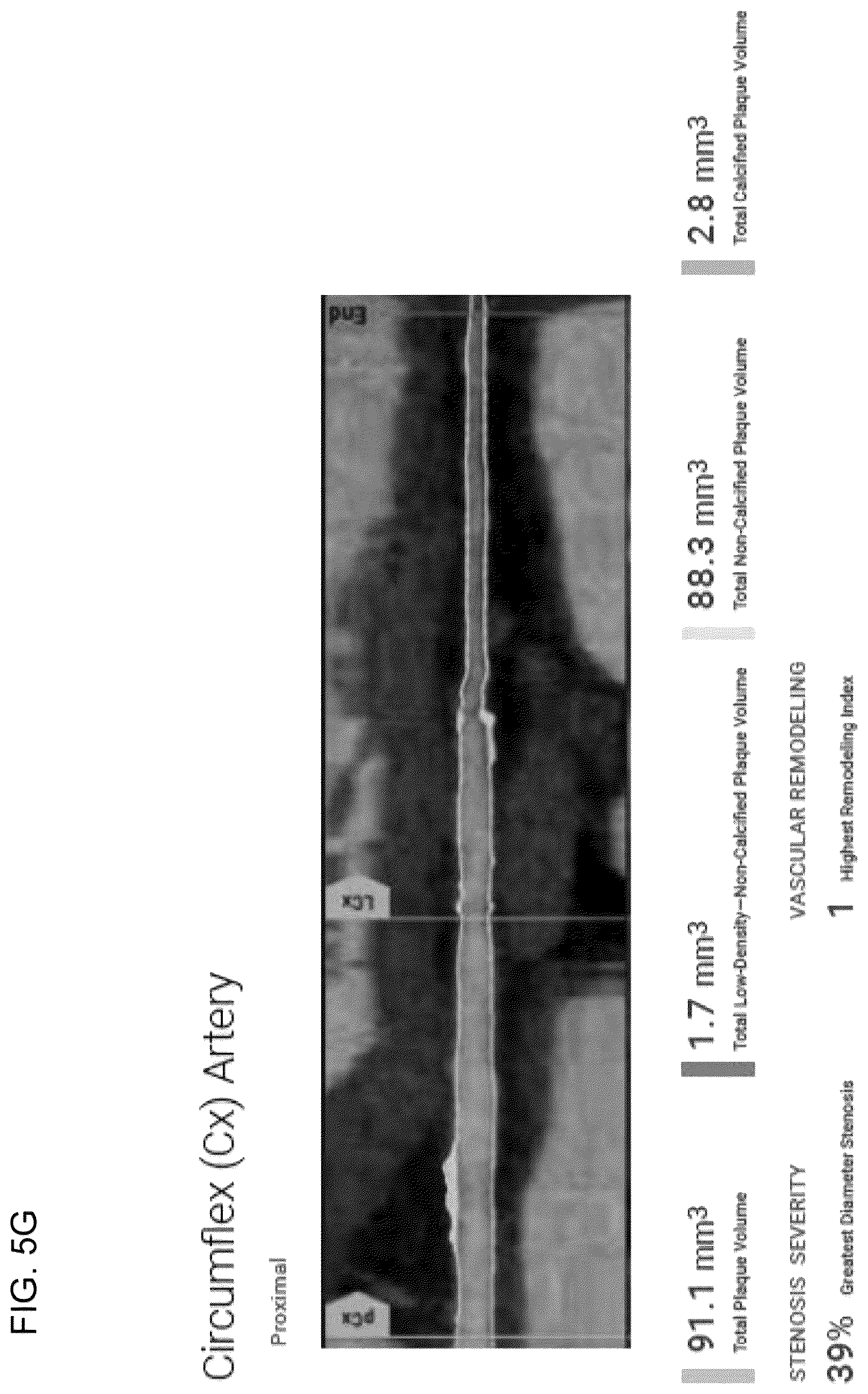 Patent US12097063 Figure 17 – Systems, methods, and devices for medical image analysis, diagnosis, risk stratification, decision making and/or disease tracking