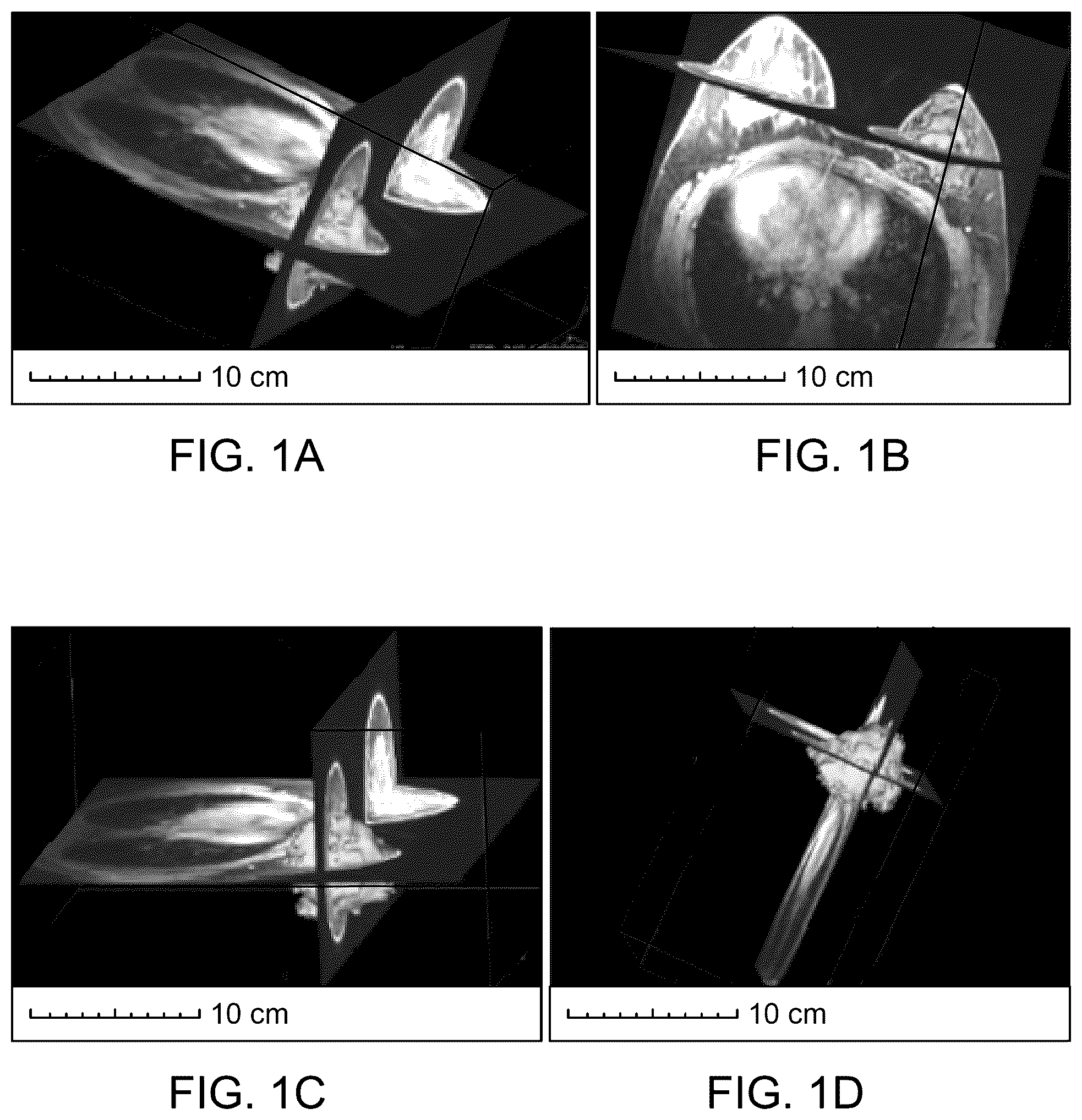 Patent US12097068 Figure 1 – Multisegment breast tissue mimic