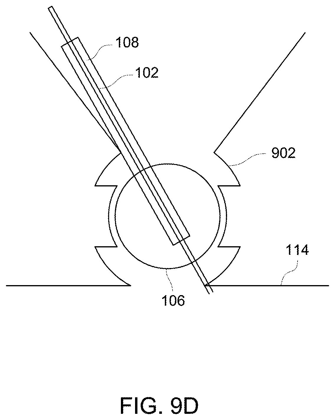 Patent US12097069 Figure 14 – Ultrasound probe with an integrated needle assembly and a computer program product, a method and a system for providing a path for inserting a needle of the ultrasound probe