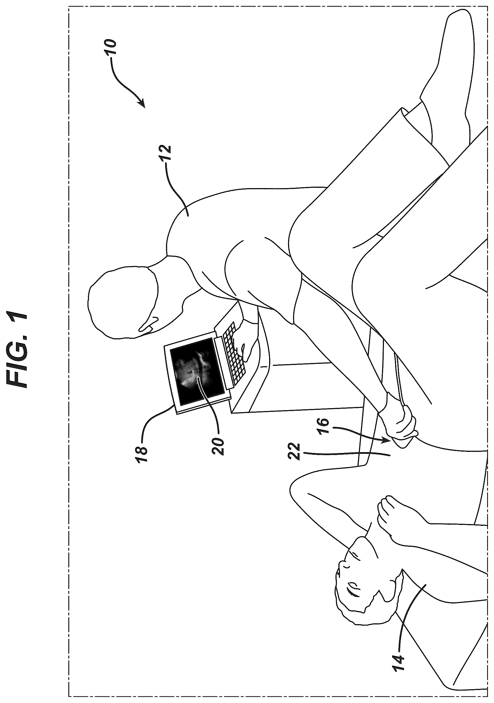 Patent US12097077 — Methods and systems for detecting heart conditions using medical imaging — Figure 1