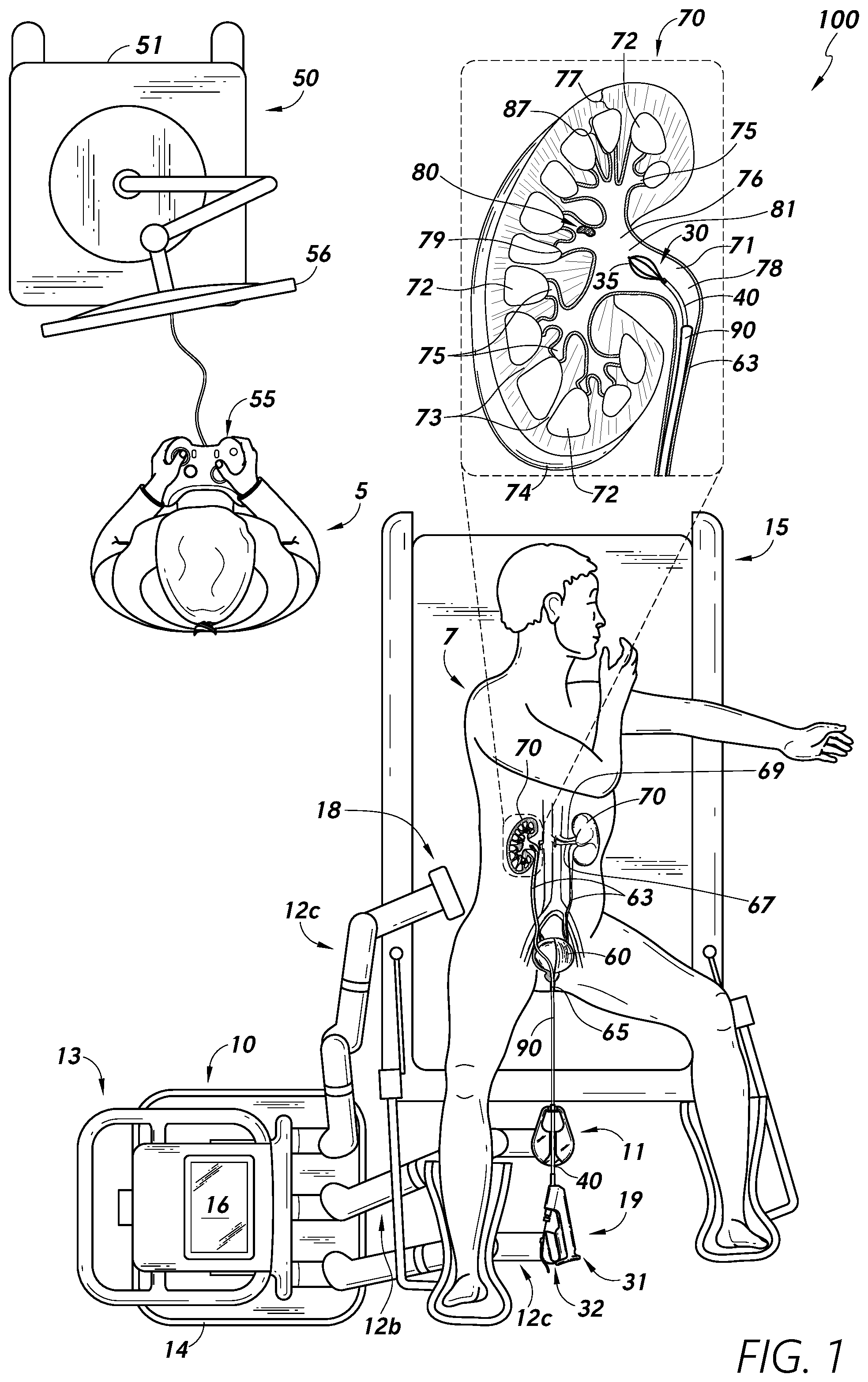 Patent US12097079 Figure 1 – Stuck instrument management