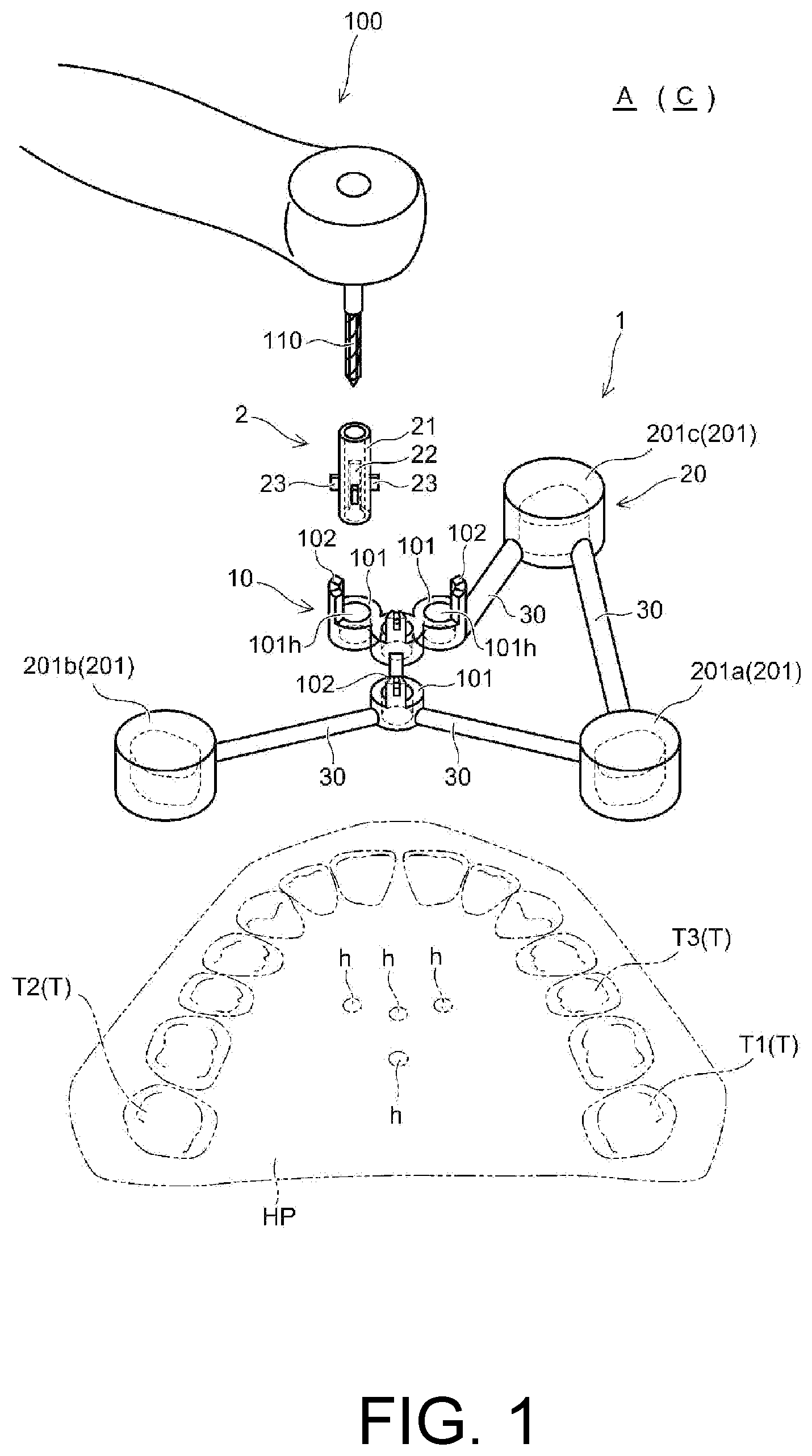 Patent US12097082 — Drill assistance device, screw guide device, and orthodontic tool installation-assisting device set — Figure 1