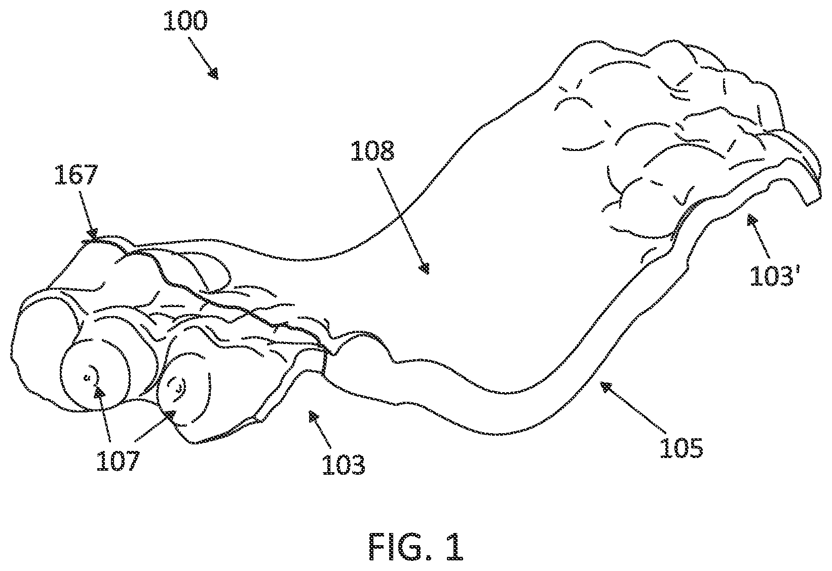 Patent US12097085 — Palatal expanders with breach regions — Figure 1