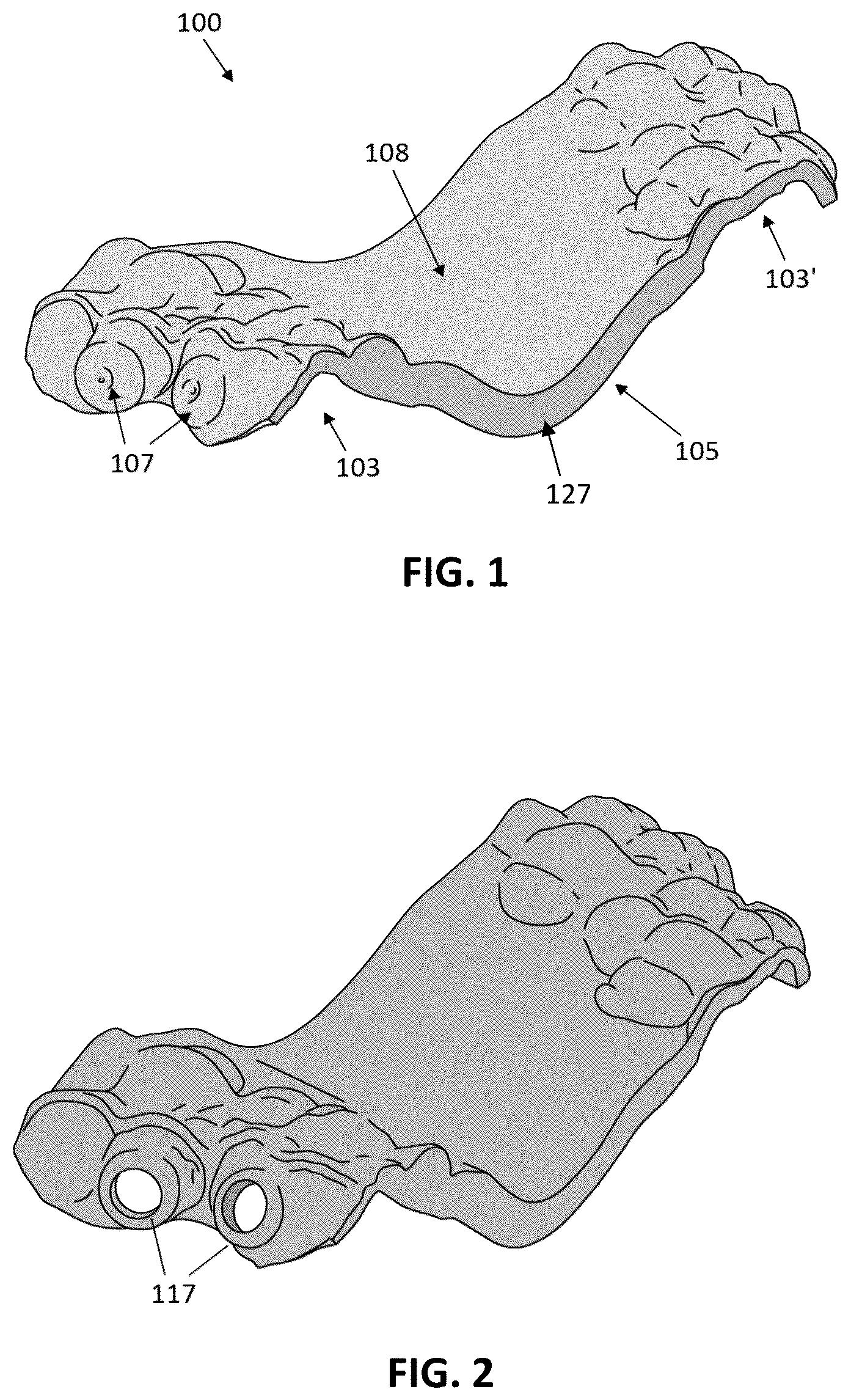 Patent US12097086 — Palatal expanders and methods of designing palatal expanders — Figure 1