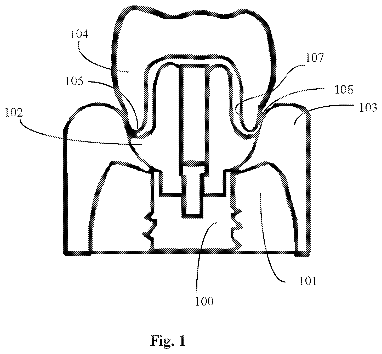 Patent US12097087 — Ceramic bodies having antimicrobial properties and methods of making the same — Figure 1