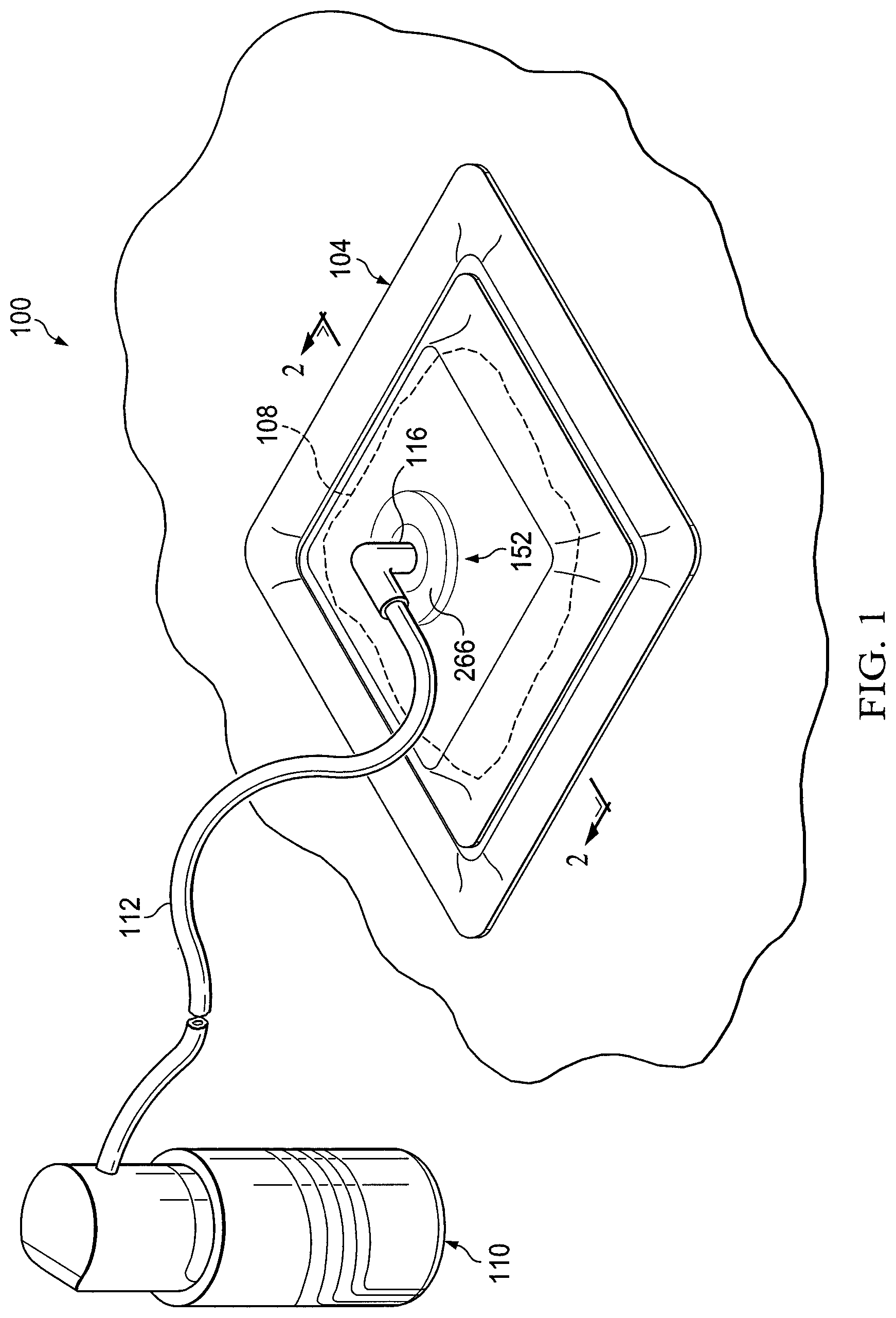 Patent US12097094 — Dressing and method for applying reduced pressure to and collecting and storing fluid from a tissue site — Figure 1