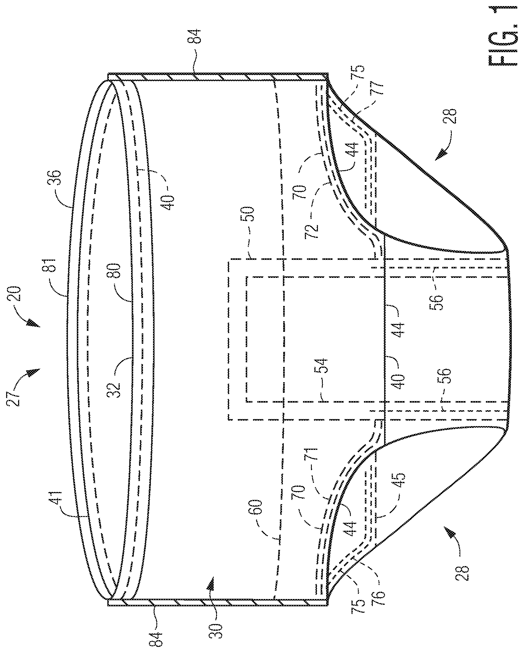 Patent US12097102 Figure 1 – Pant-like disposable absorbent articles with improved chassis construction