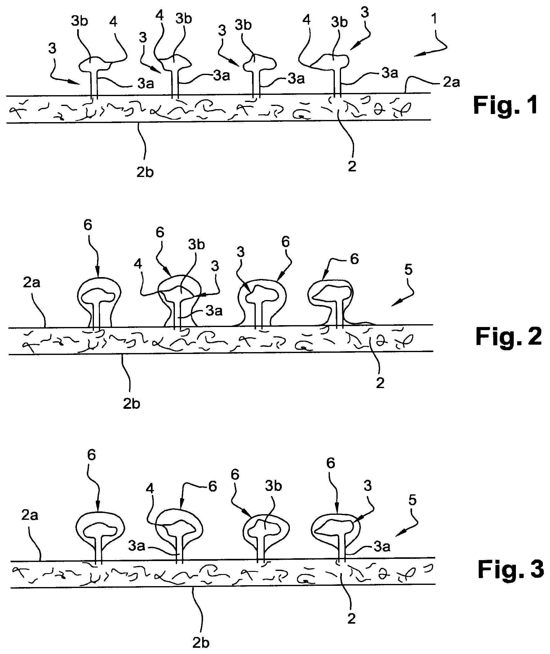Patent US12097107 — Fabric with barbs coated with a water-soluble material — Figure 1