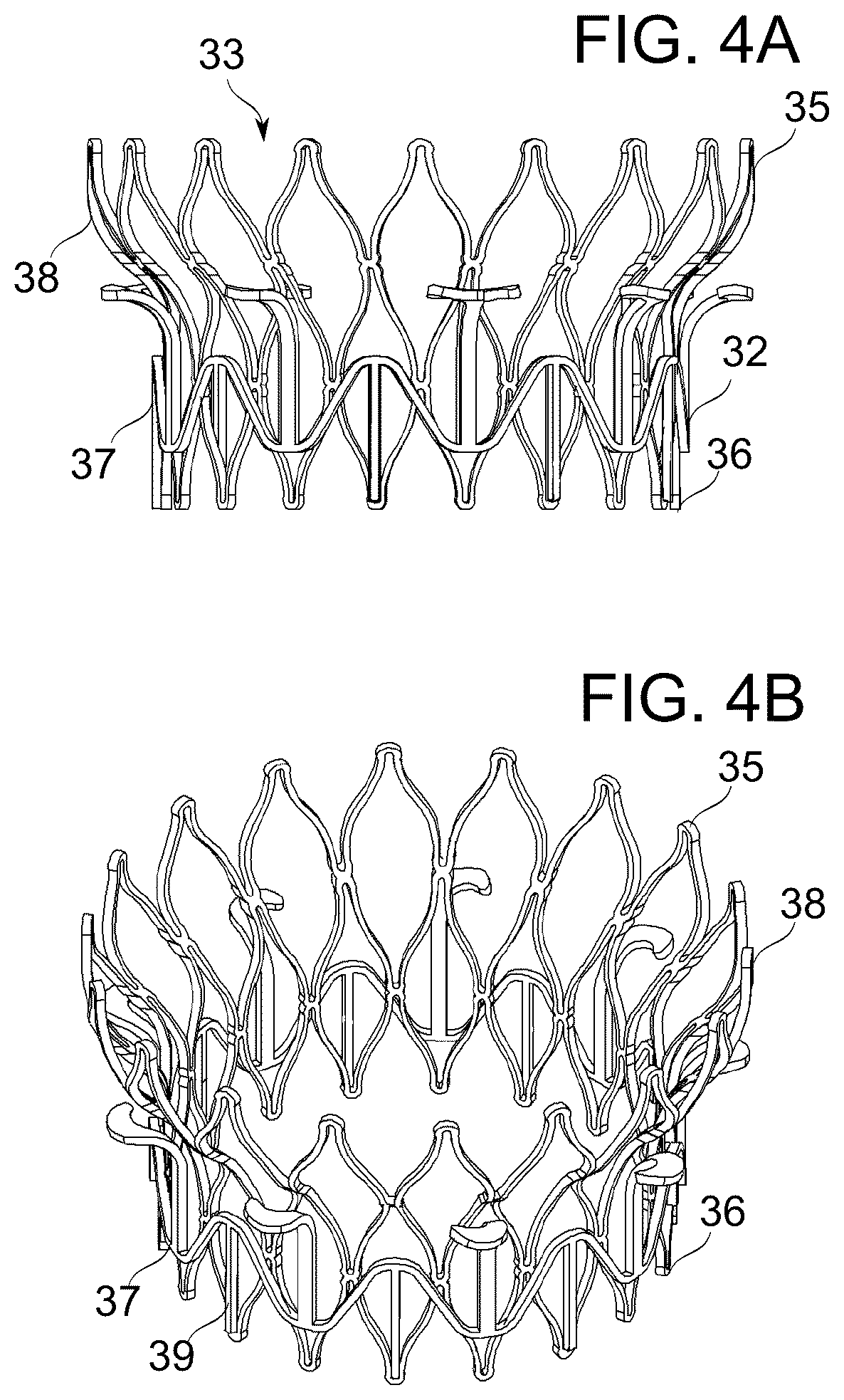 Patent US12097114 Figure 5 – Ventricular structure reshaping atrio-ventricular valve