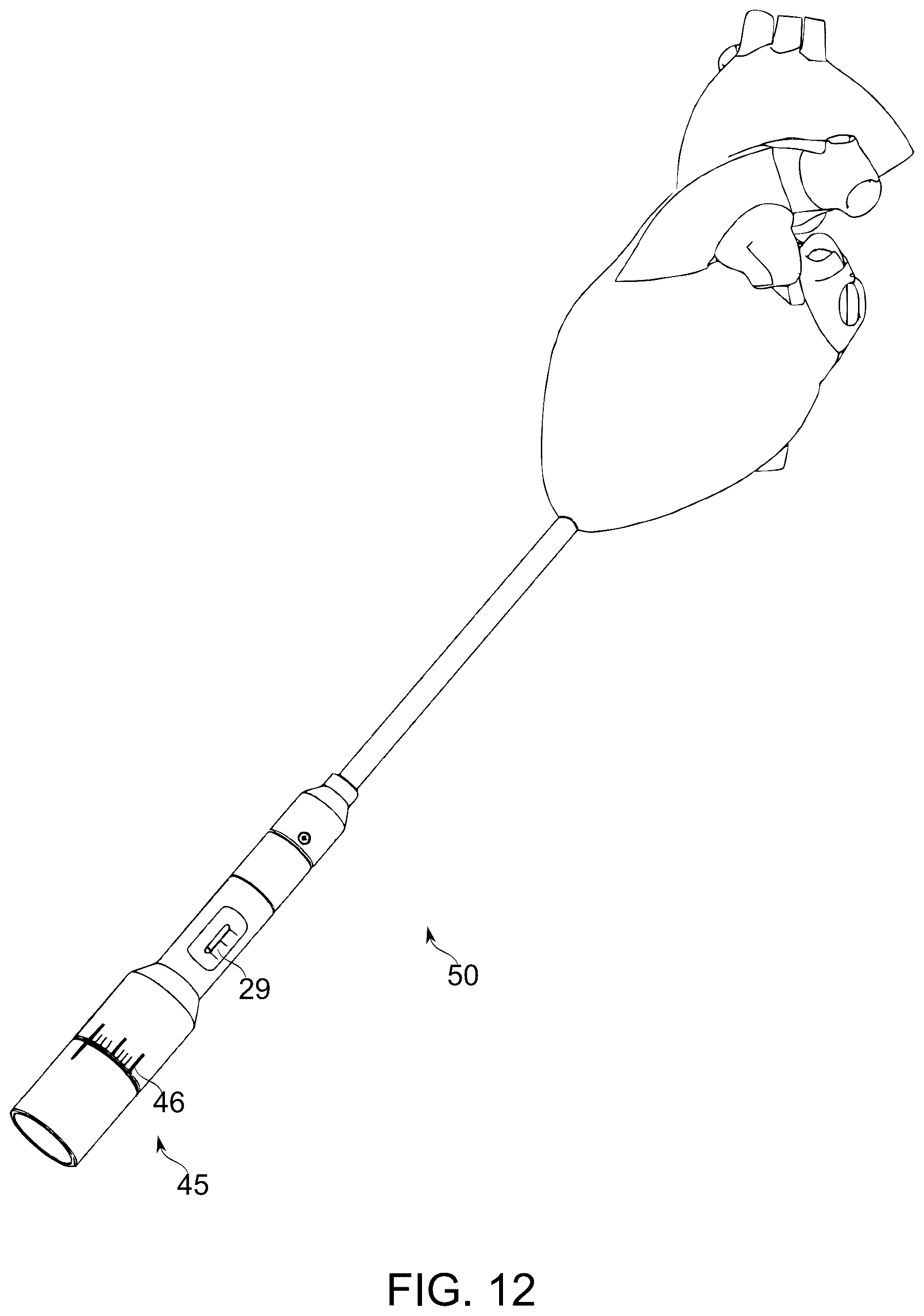 Patent US12097114 Figure 14 – Ventricular structure reshaping atrio-ventricular valve