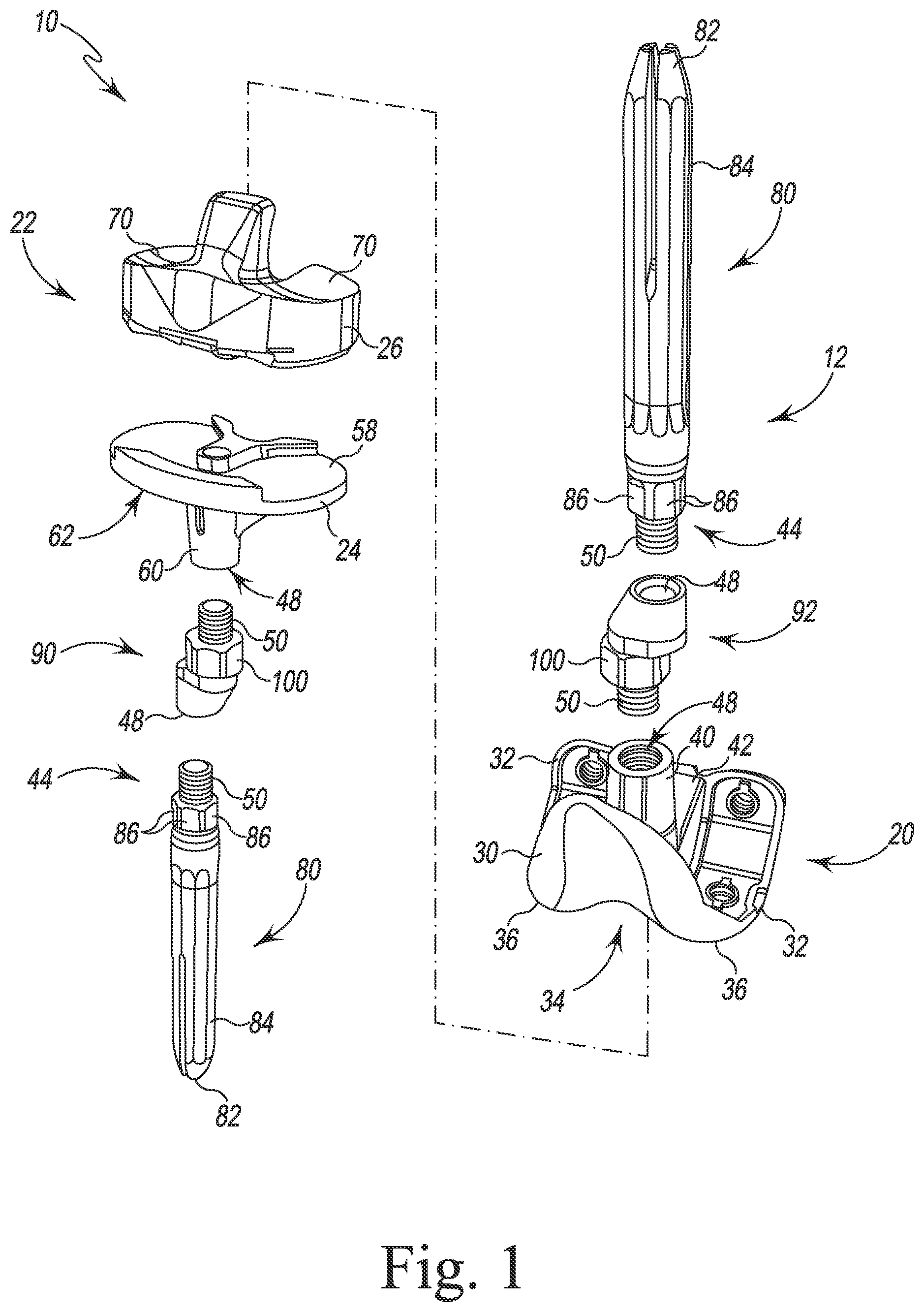 Patent US12097128 — System and method for preparing a patient's femur in an orthopaedic joint replacement procedure — Figure 1