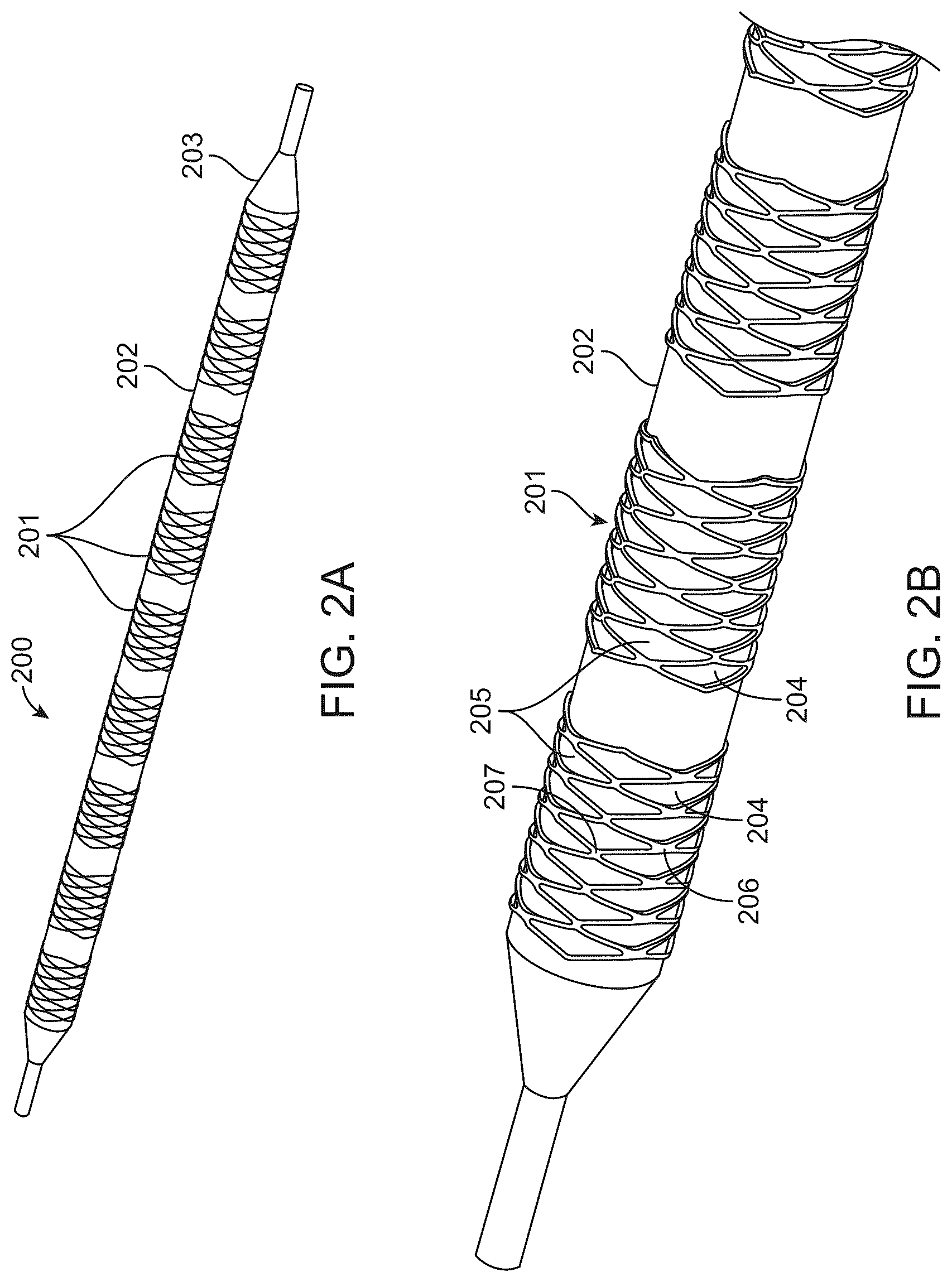 Patent US12097134 Figure 2 – Absorbable intravascular devices that provide a decrease in radial rigidity of the vessel over time