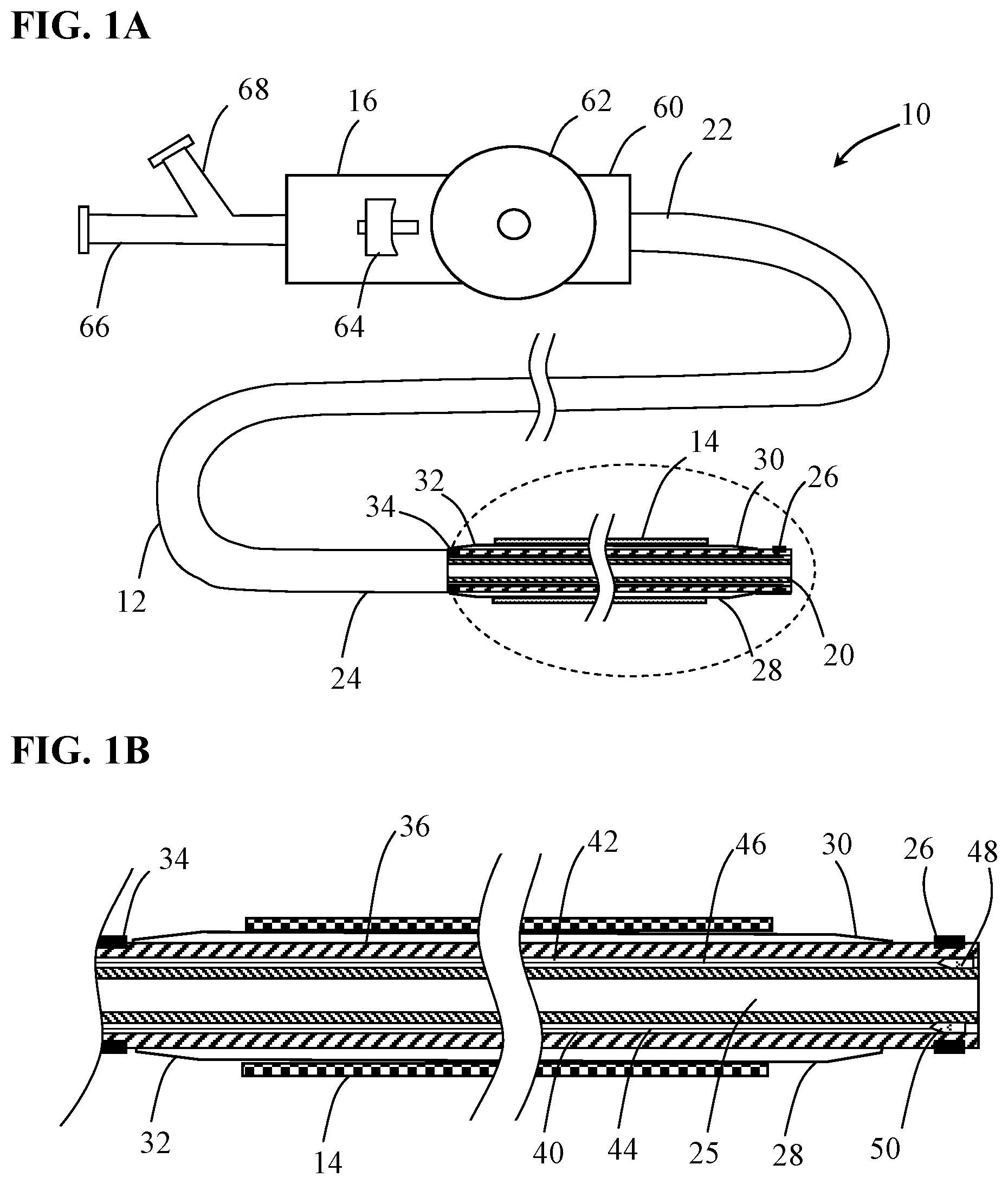 Patent US12097137 — Systems and methods for intravascular procedures — Figure 1