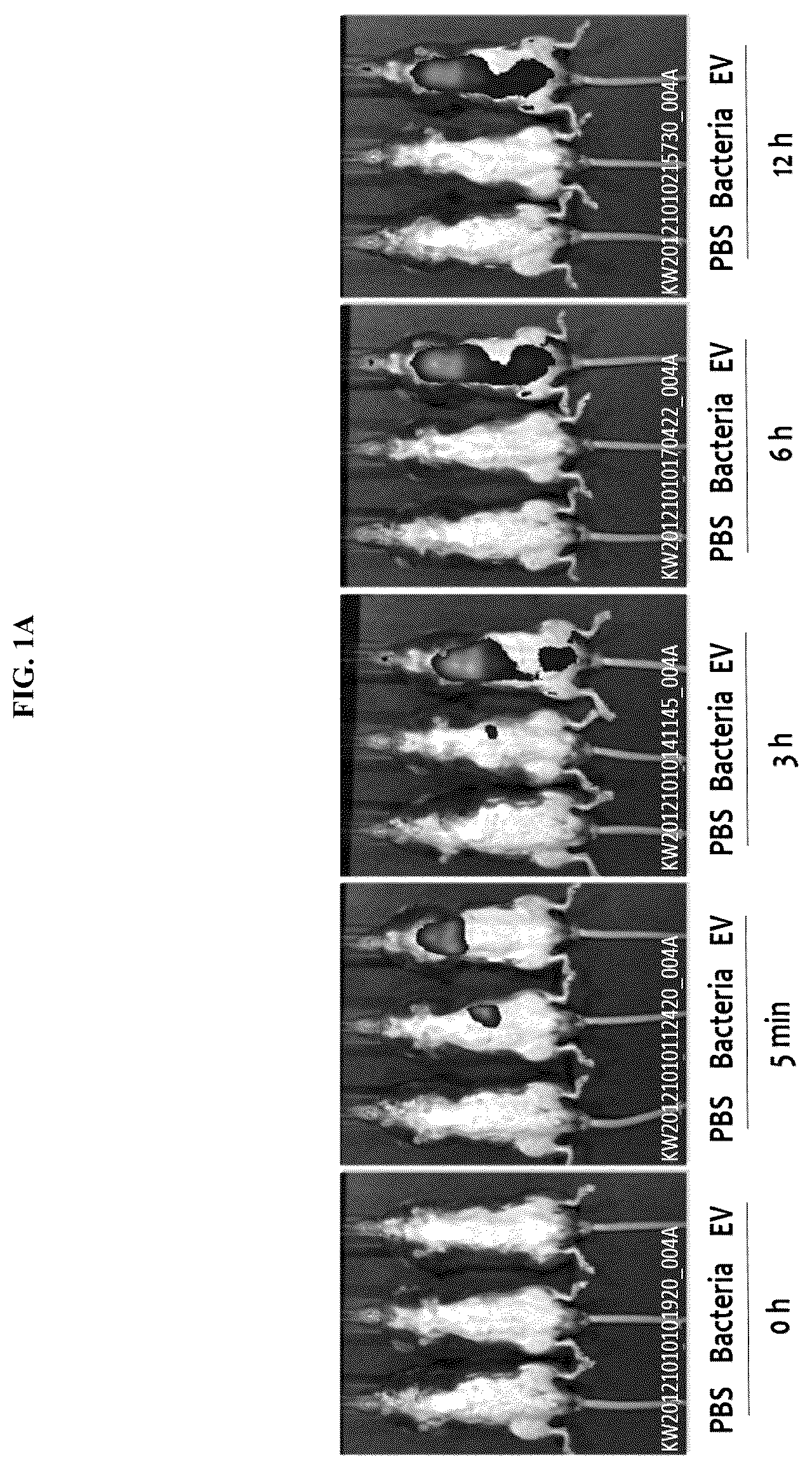 Patent US12097227 — Nanovesicles derived from bacteria of Lactococcus genus and use thereof — Figure 1