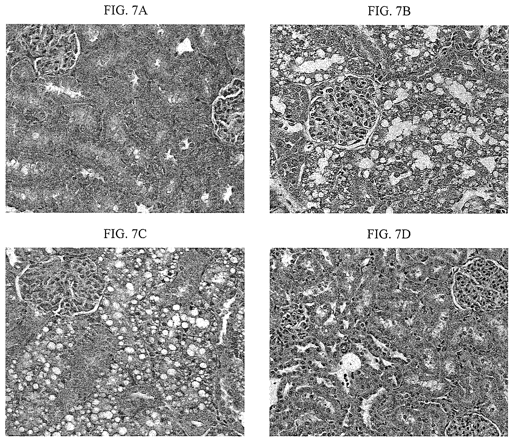 Patent US12097241 Figure 3 – Methods of treating kidney failure, and/or improving or stablizing renal function using modified relaxin polypeptides
