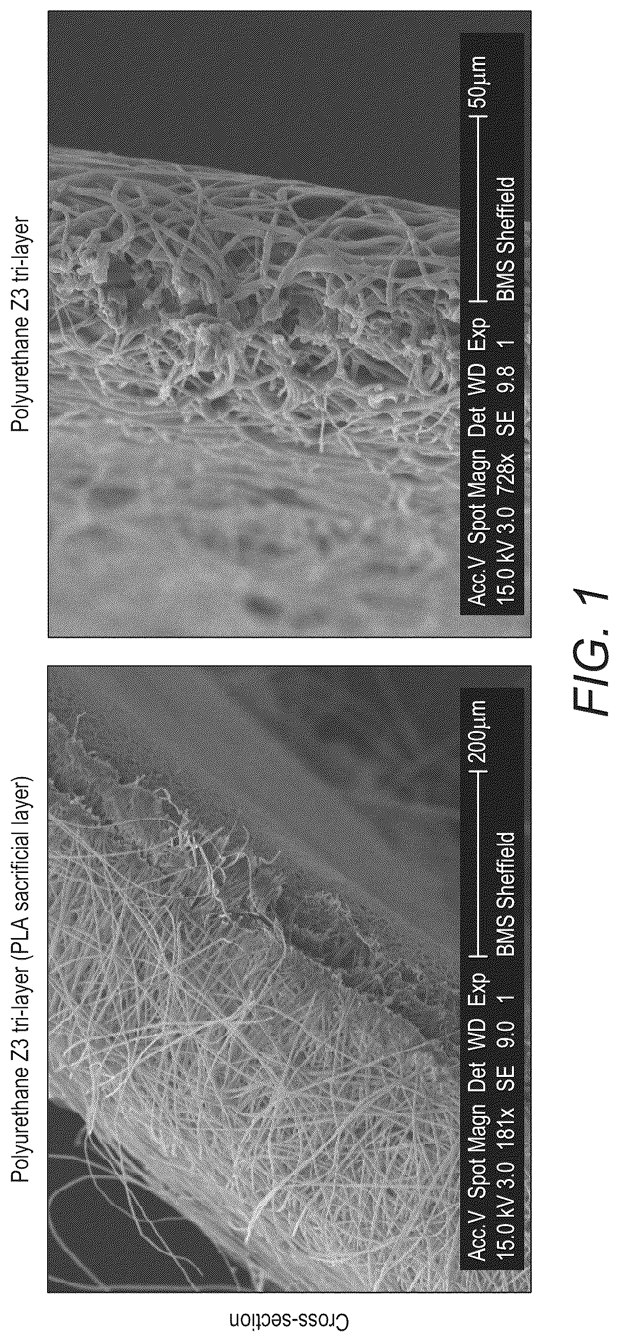 Patent US12097301 — Scaffold — Figure 1