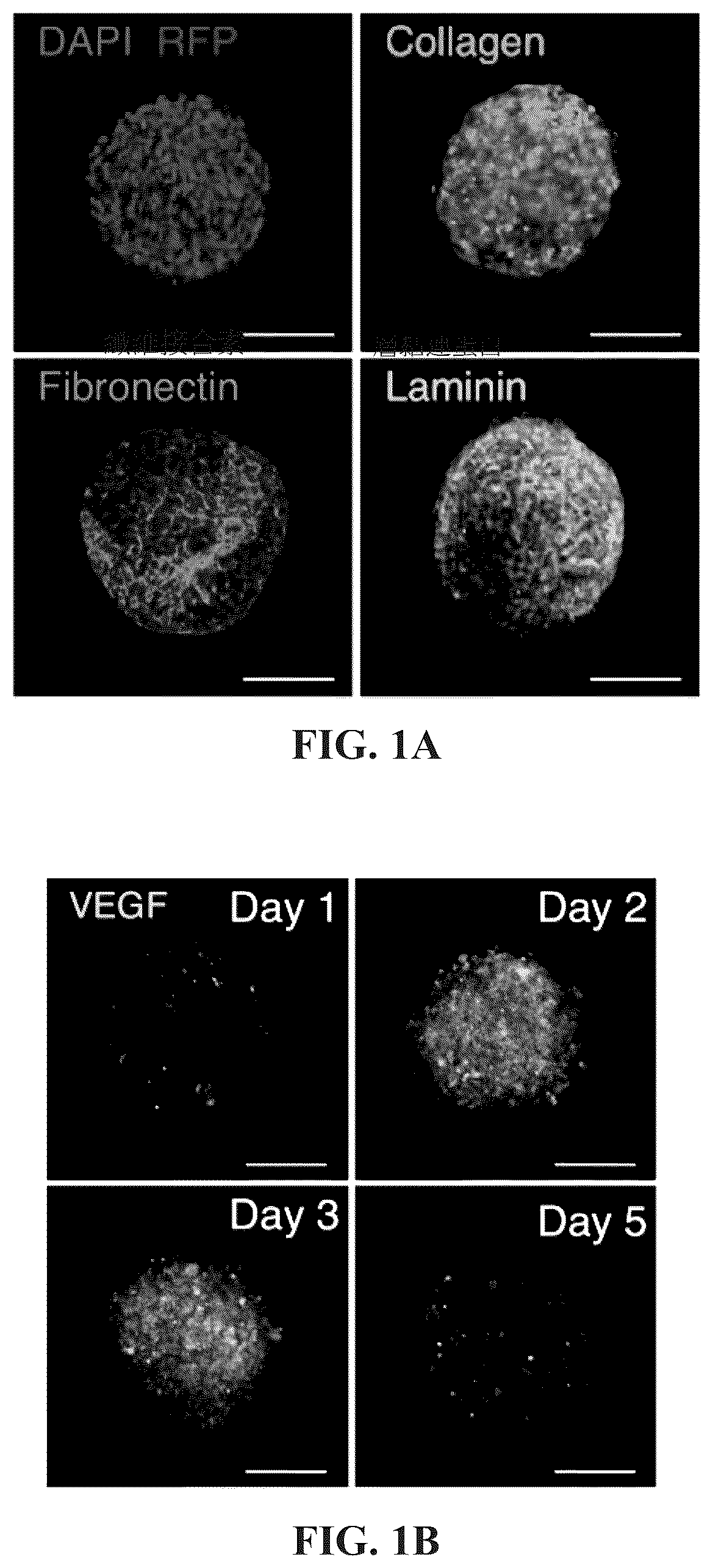 Patent US12097303 — Decellularized extracellular matrix, preparation process and uses thereof — Figure 1