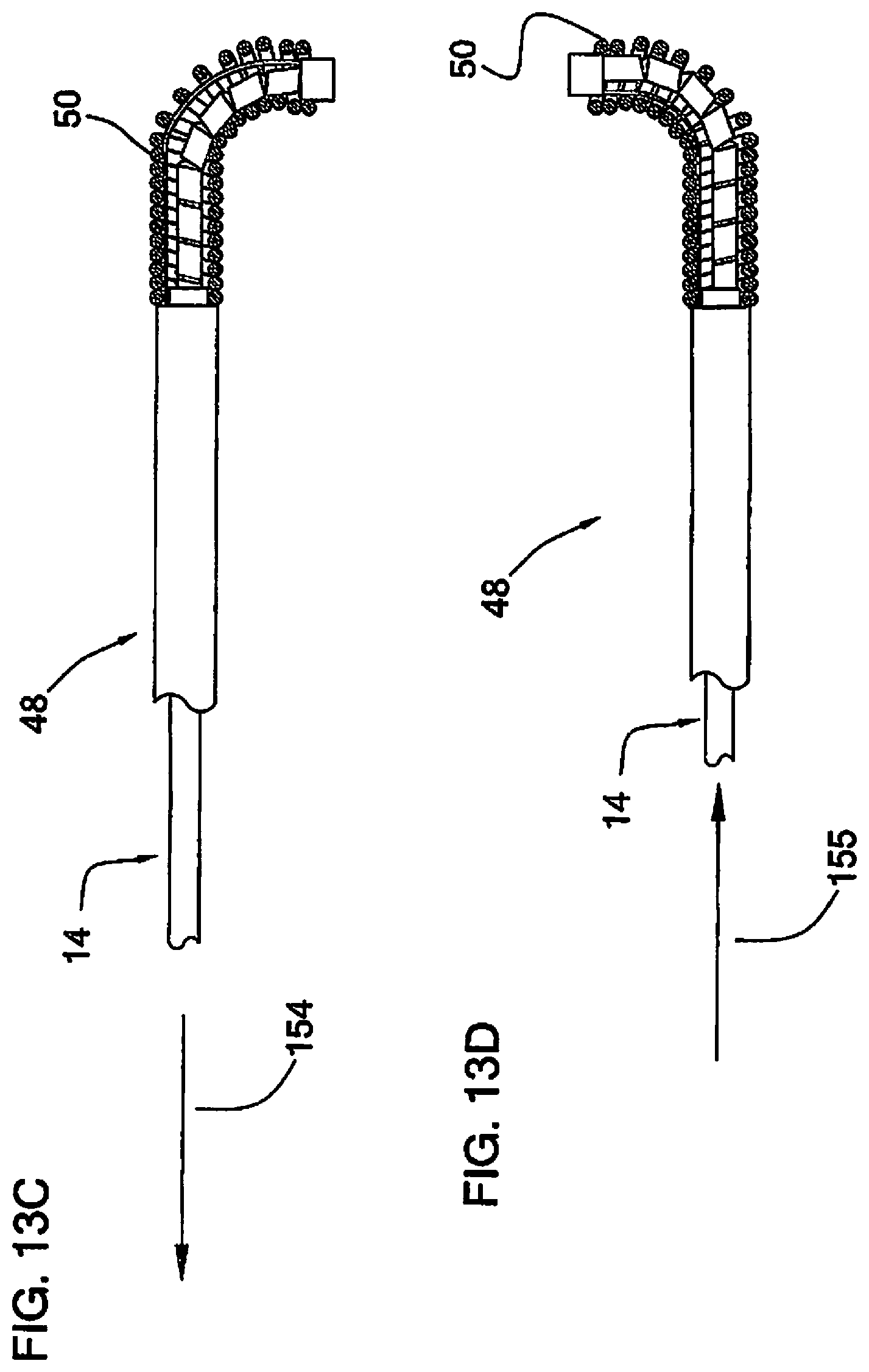 Patent US12097338 Figure 9 – Coaxial bi-directional catheter