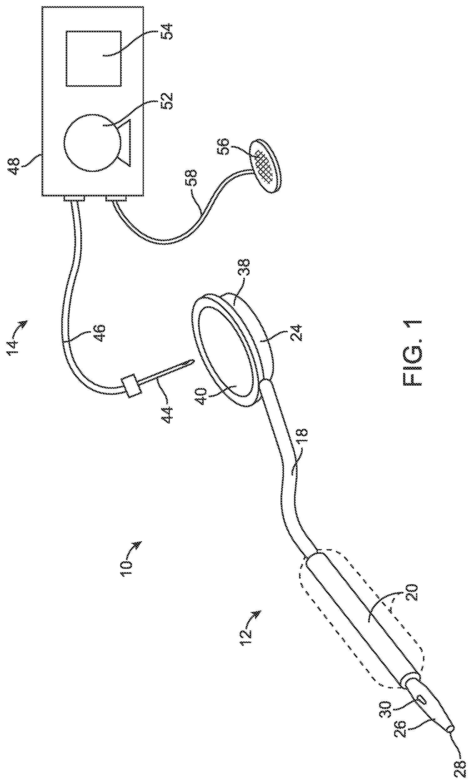 Patent US12097364 — Apparatus, systems, and methods for percutaneous pneumatic cardiac assistance — Figure 1