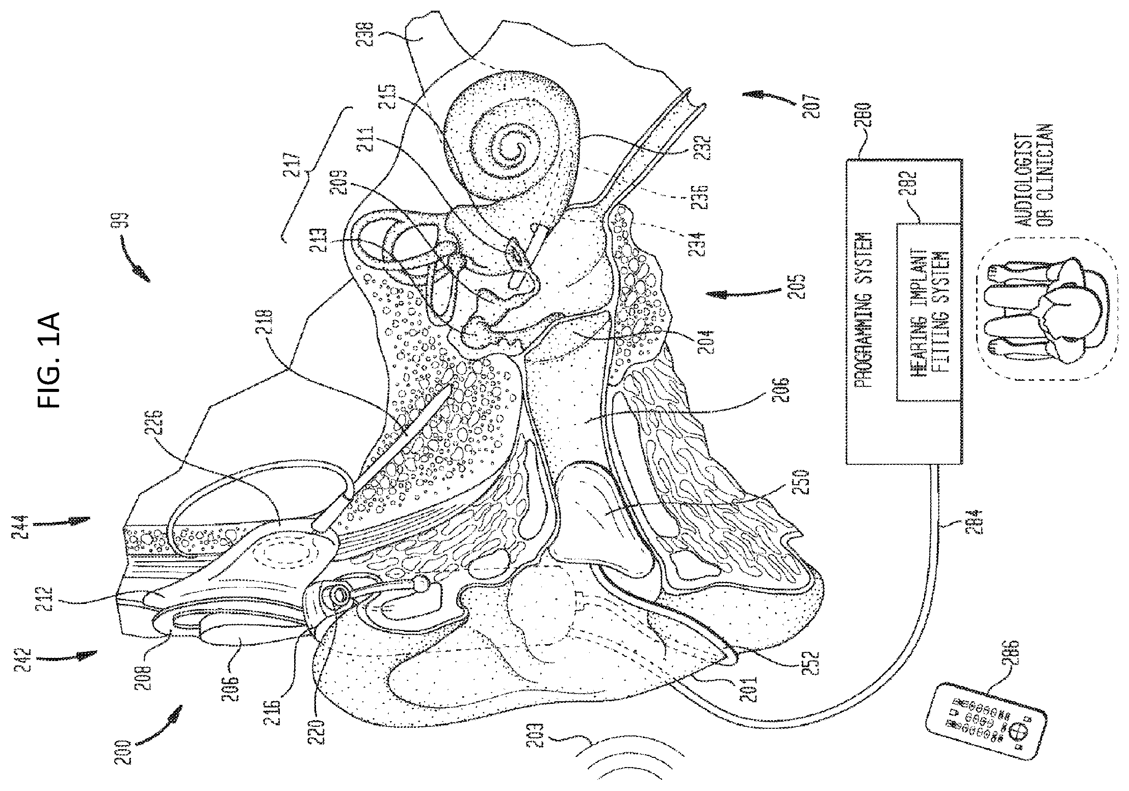 Patent US12097370 — Multimodal prescription techniques — Figure 1