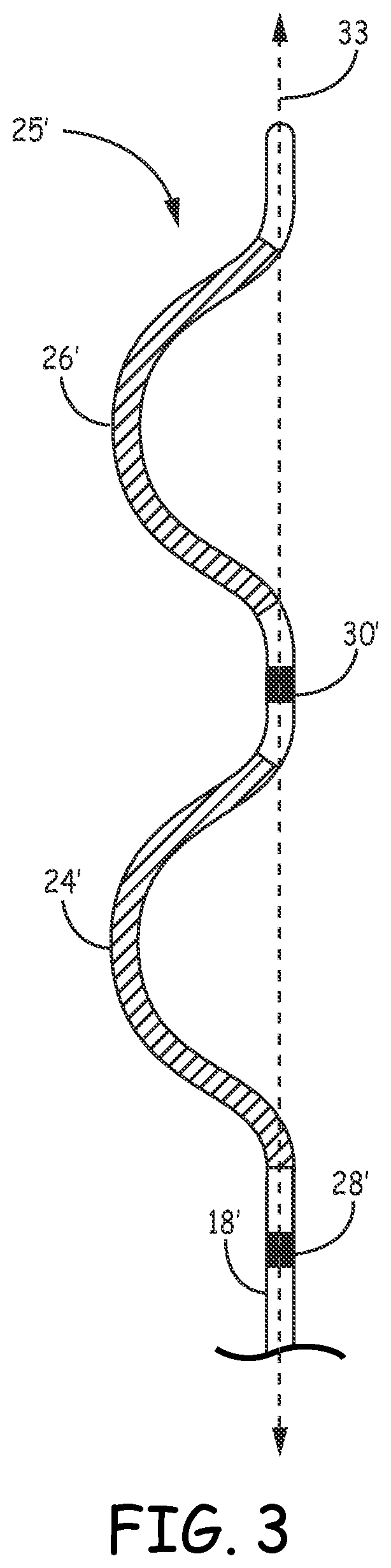 Patent US12097377 Figure 6 – Asystole detection and response in an implantable cardioverter defibrillator