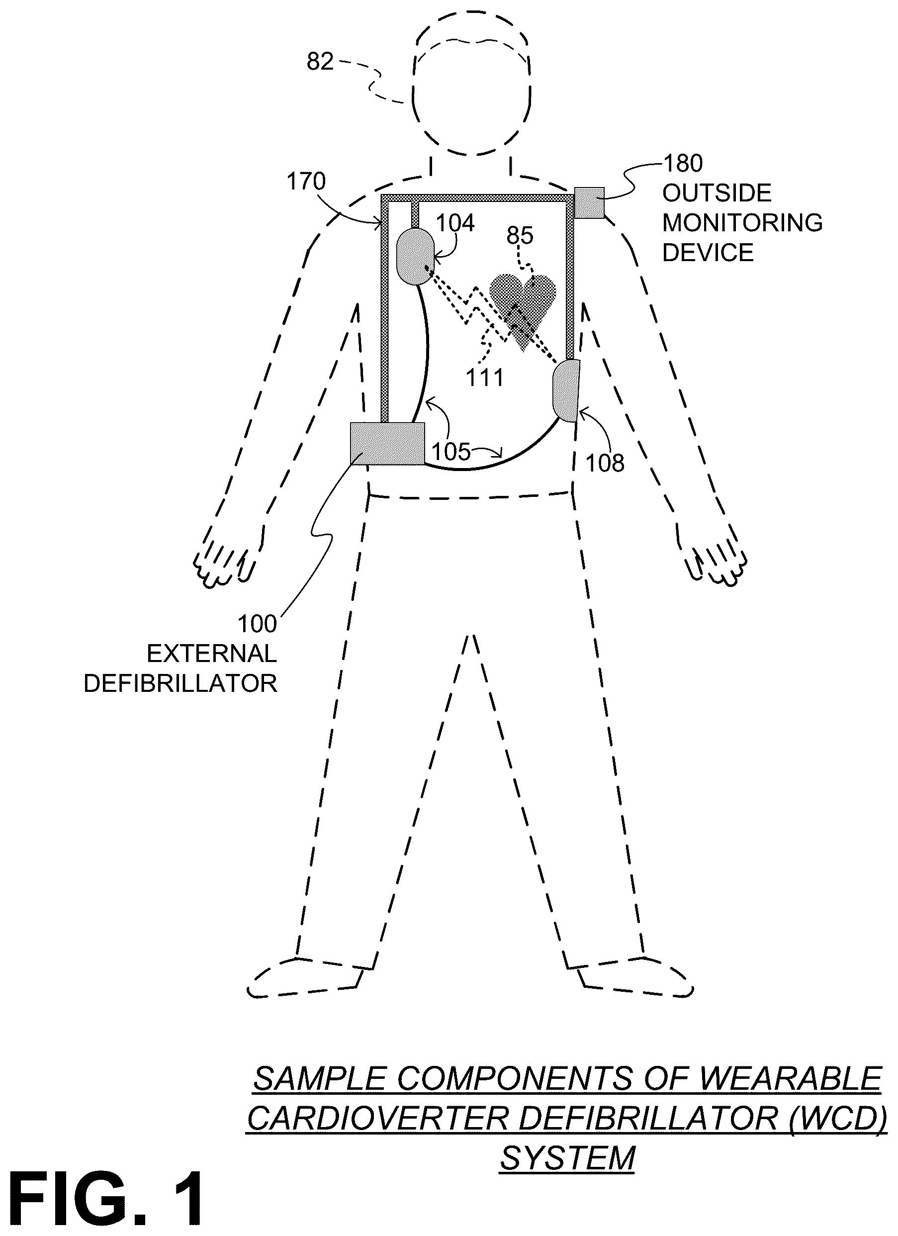 Patent US12097379 — Wearable cardioverter defibrillator (WCD) system making shock/no shock determinations from multiple patient parameters — Figure 1