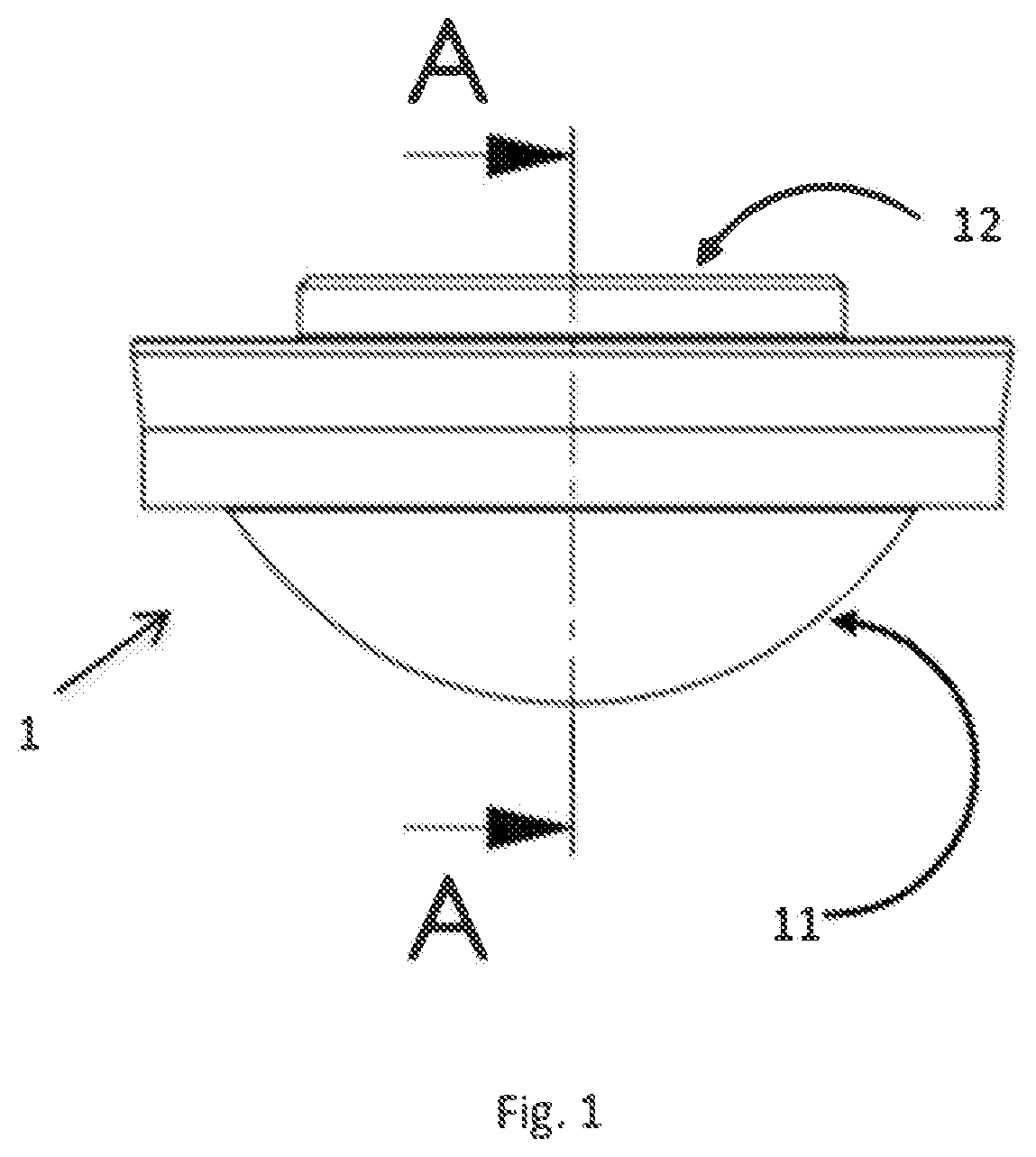 Patent US12097646 — Method for manufacturing an articular prosthesis implant using a ceramic imprint — Figure 1